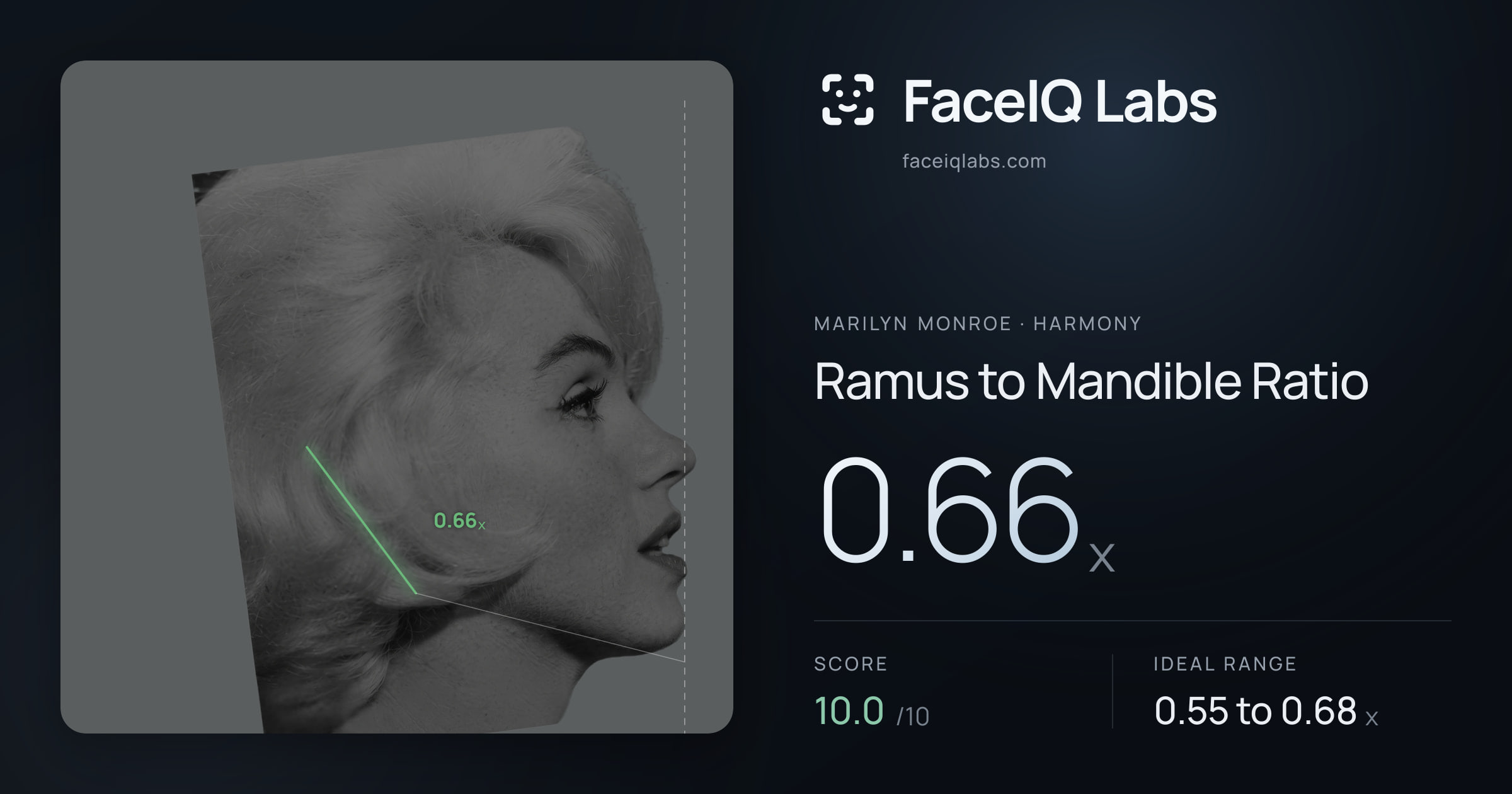 Marilyn Monroe Ramus to Mandible Ratio: 0.66x, drawn on the photo