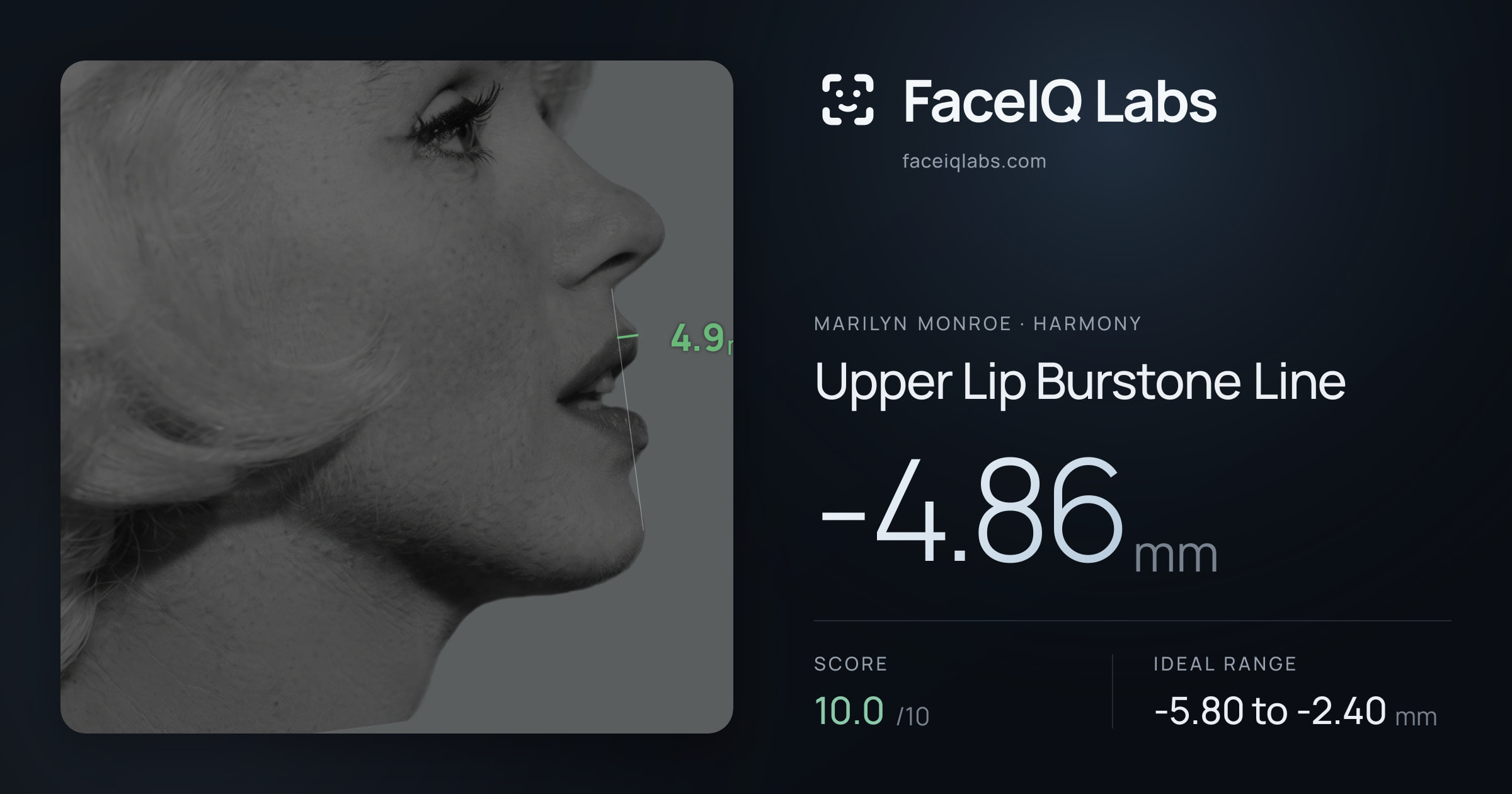 Marilyn Monroe Upper Lip Burstone Line: -4.86mm, drawn on the photo