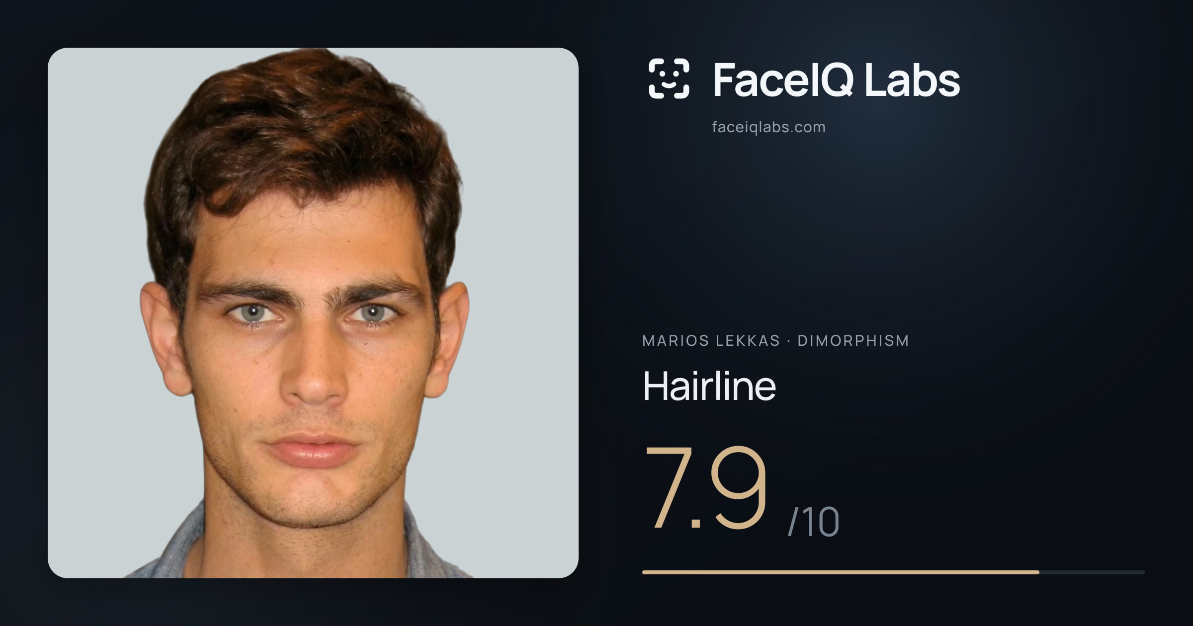 Marios Lekkas Hairline: 7.9/10, drawn on the photo
