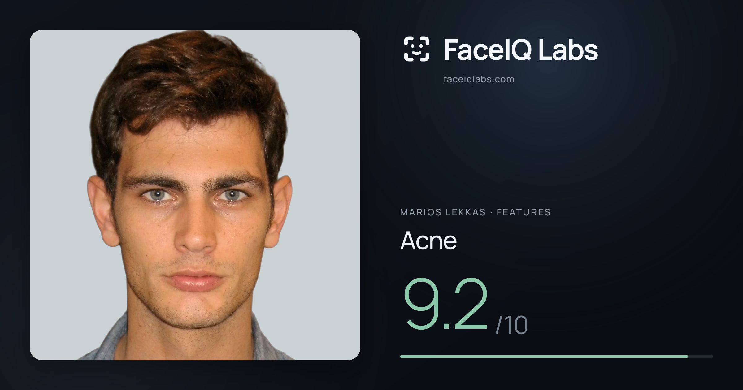 Marios Lekkas Acne: 9.2/10, drawn on the photo