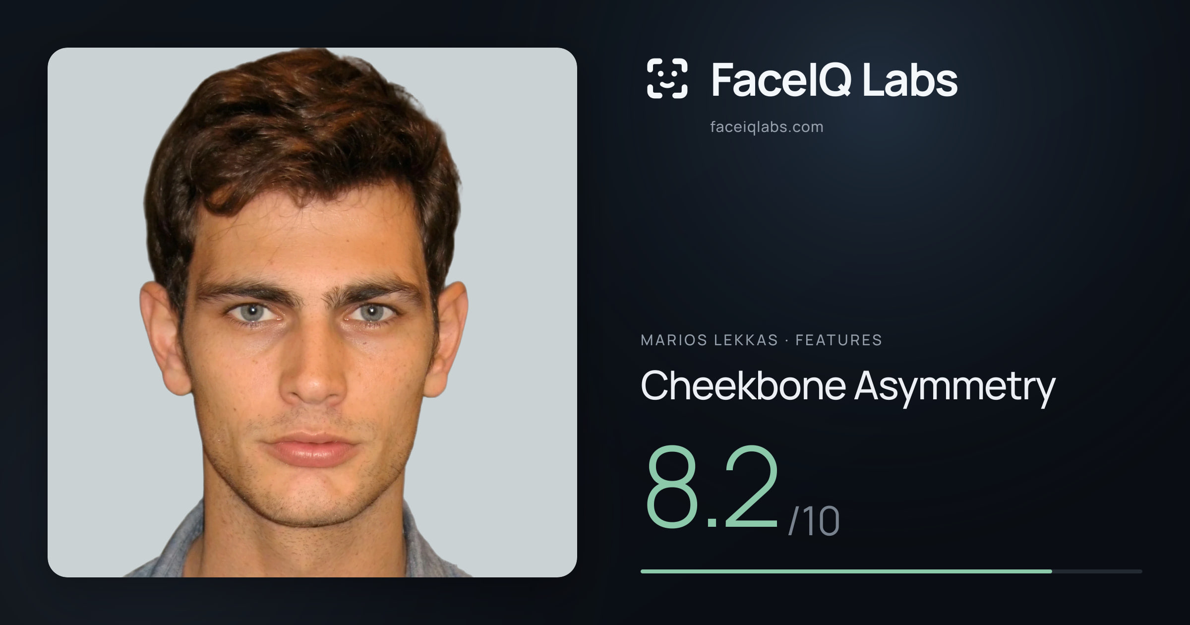 Marios Lekkas Cheekbone Asymmetry: 8.2/10, drawn on the photo