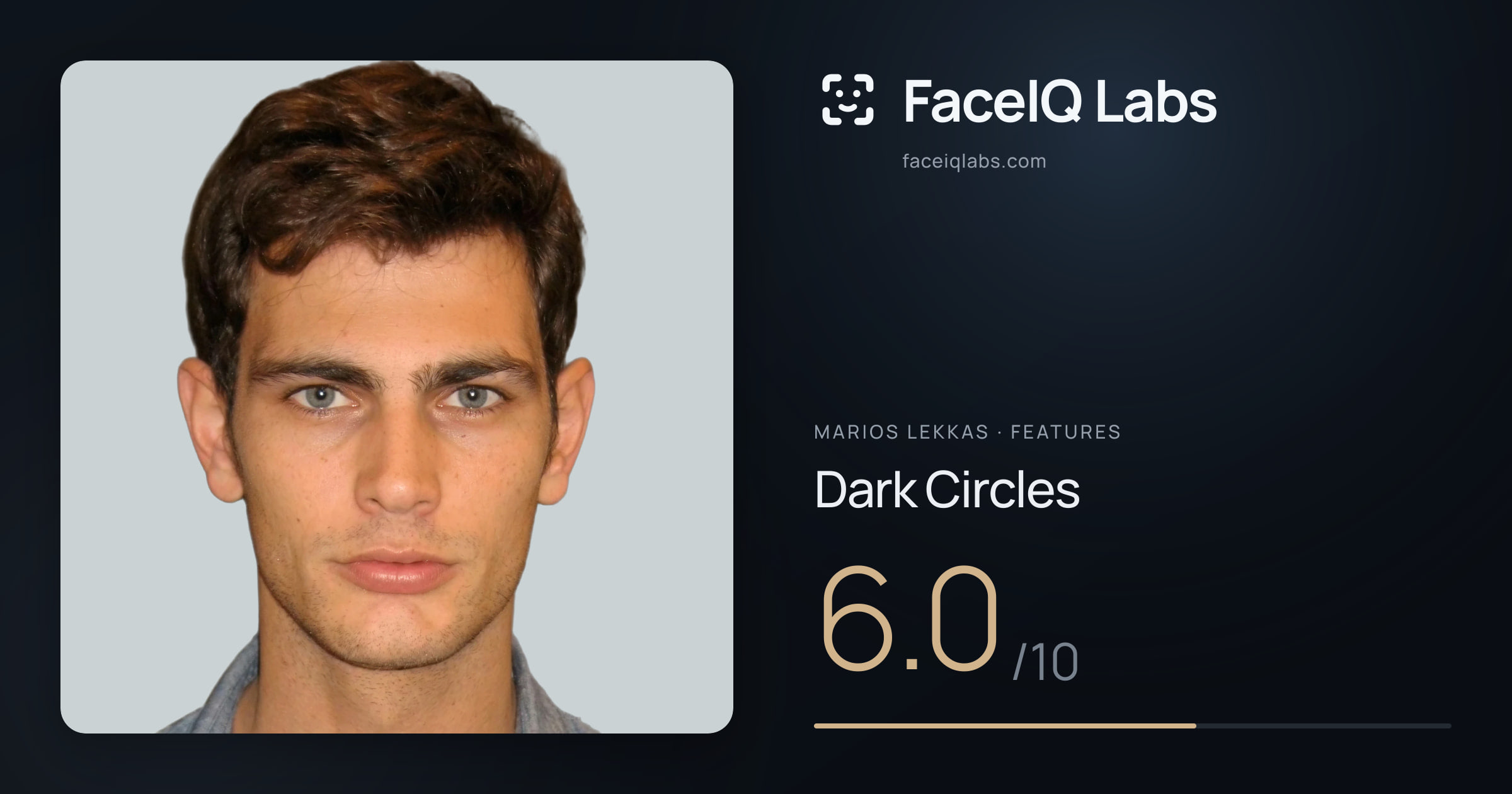 Marios Lekkas Dark Circles: 6.0/10, drawn on the photo