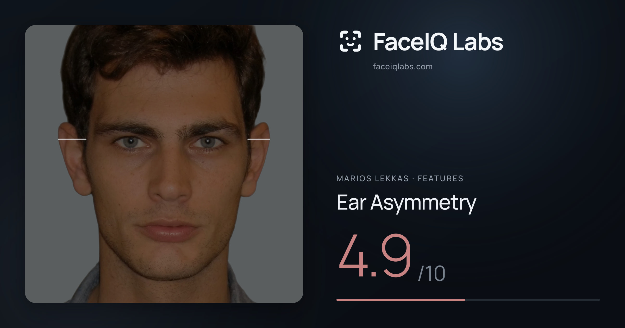 Marios Lekkas Ear Asymmetry: 4.9/10, drawn on the photo