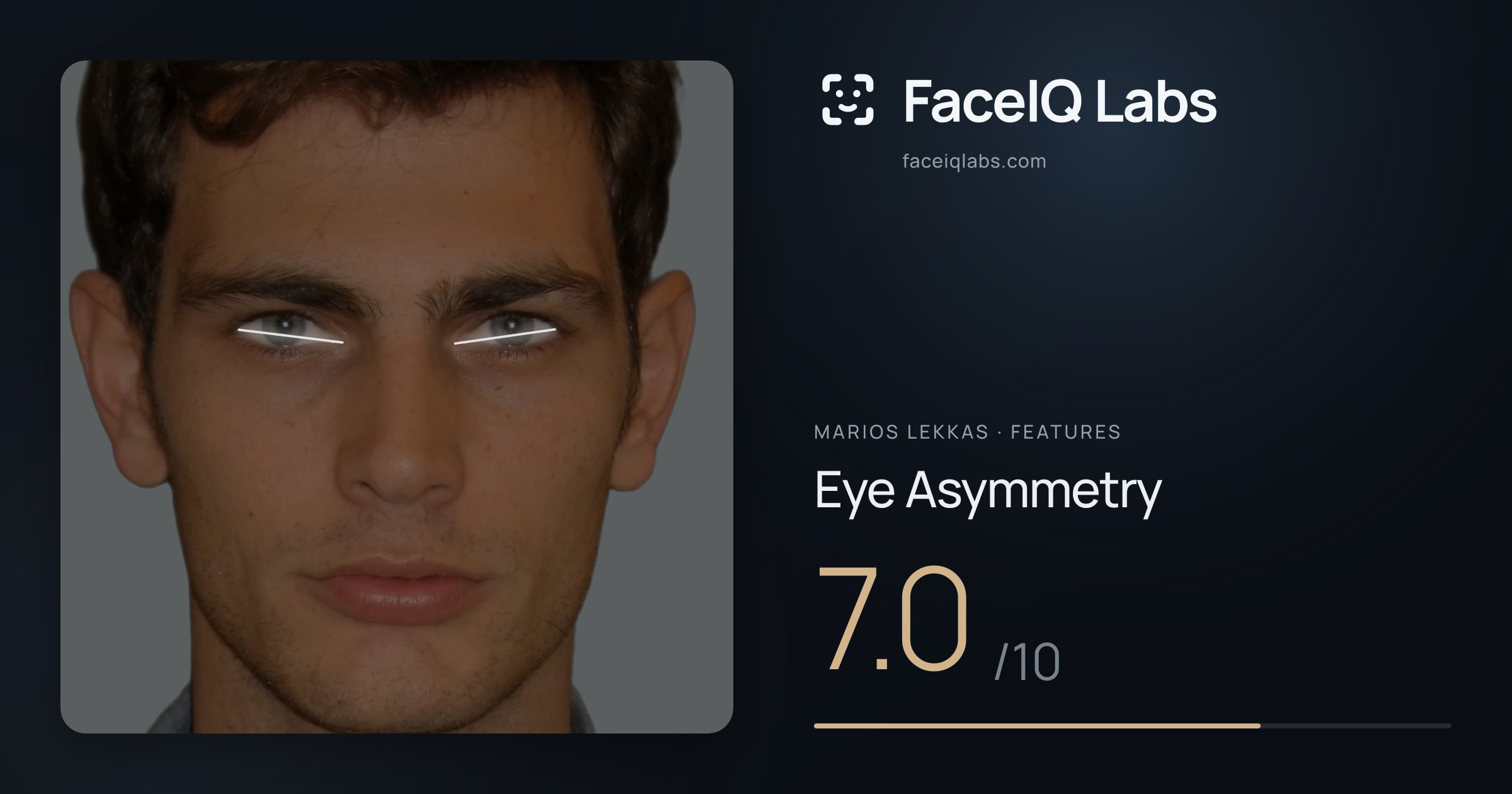 Marios Lekkas Eye Asymmetry: 7.0/10, drawn on the photo