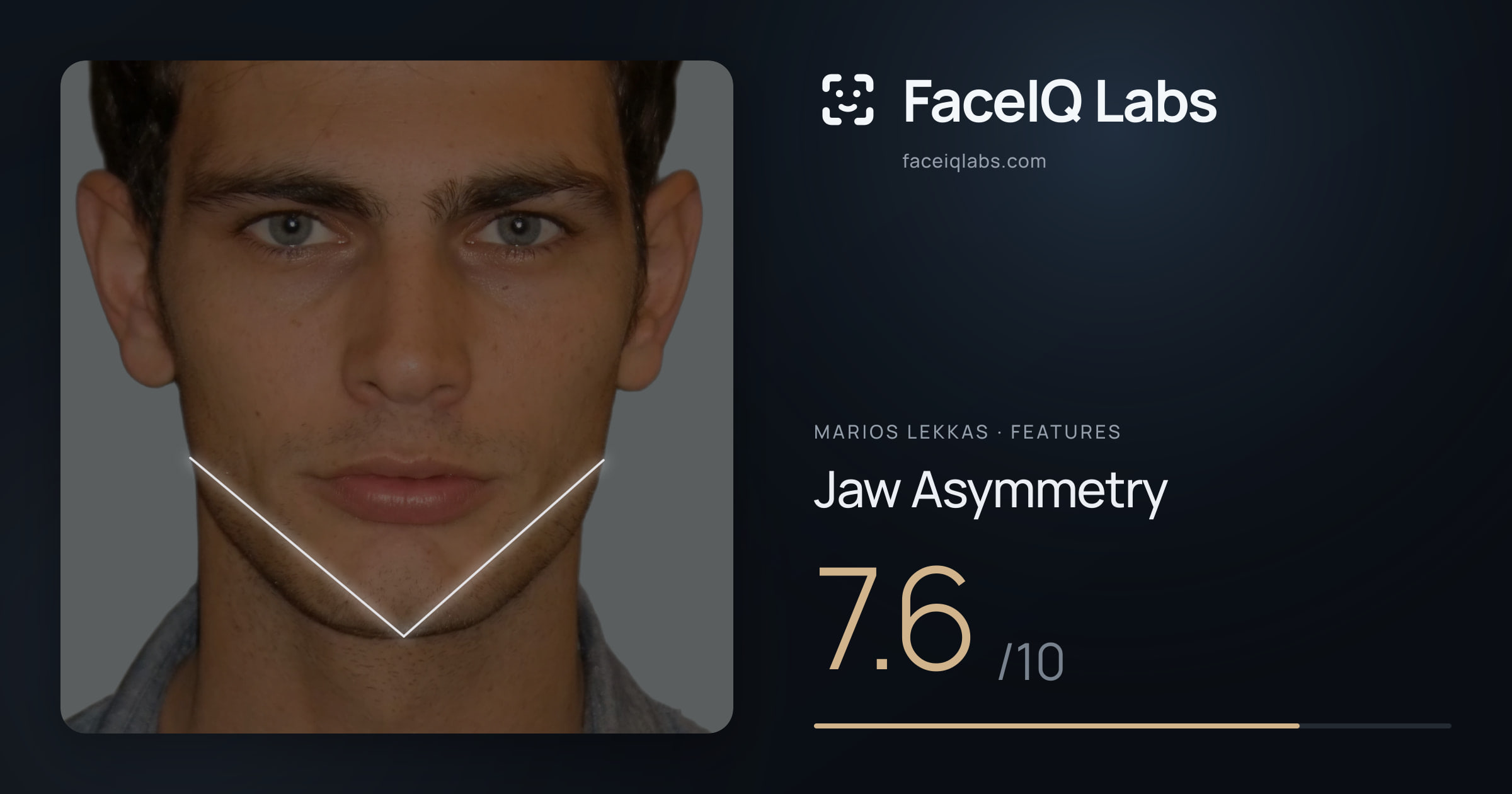 Marios Lekkas Jaw Asymmetry: 7.6/10, drawn on the photo
