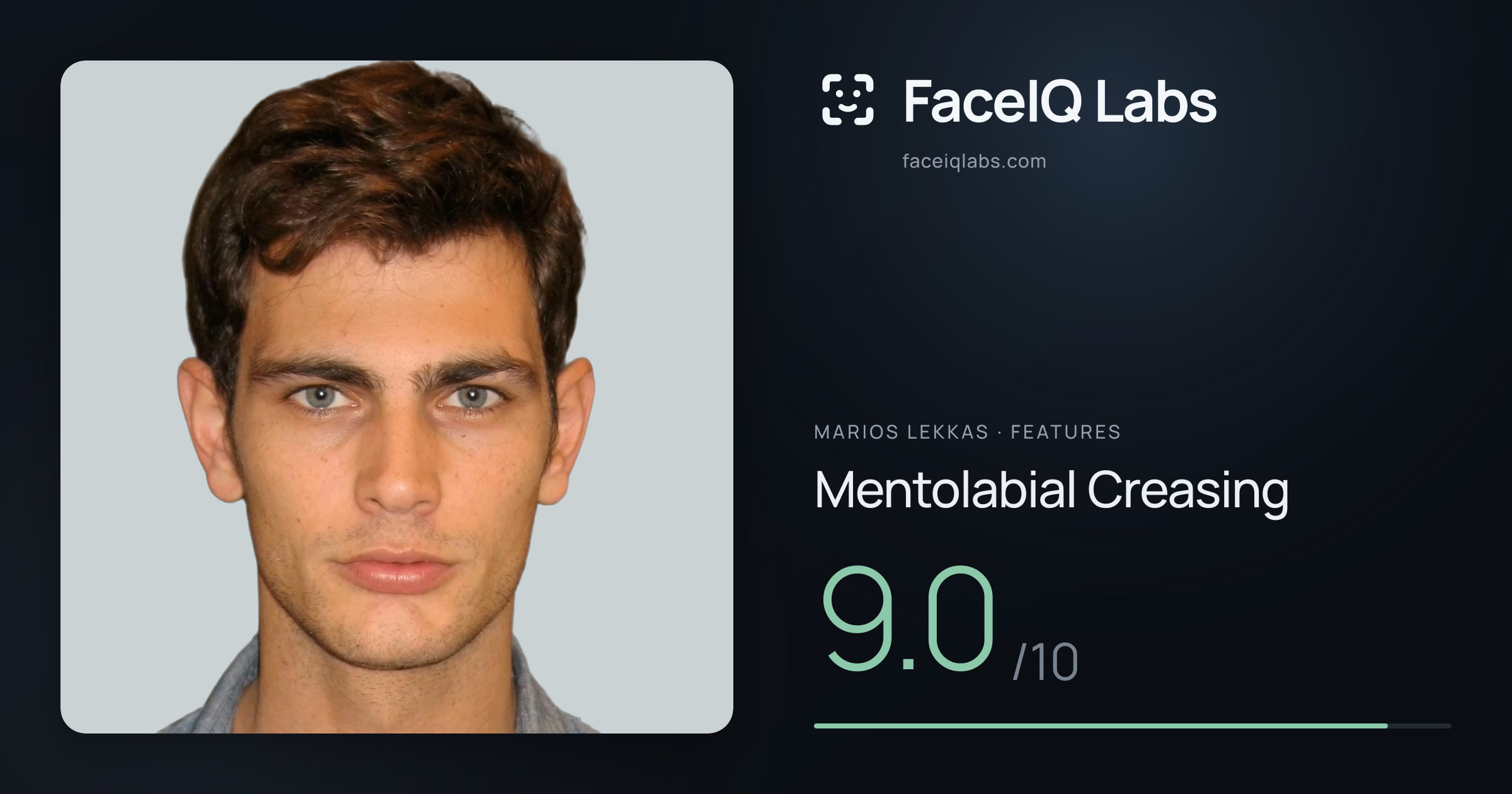 Marios Lekkas Mentolabial Creasing: 9.0/10, drawn on the photo