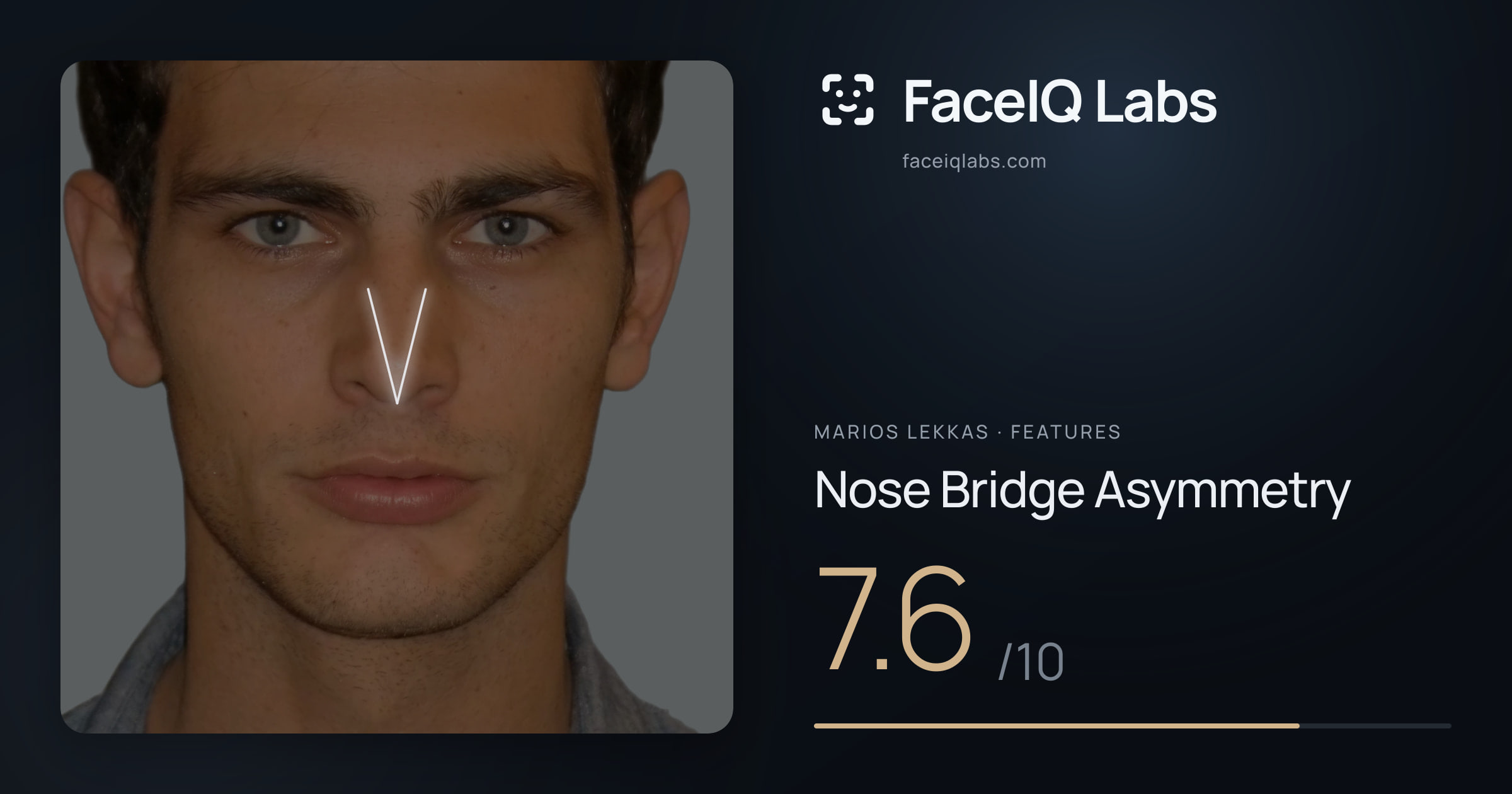 Marios Lekkas Nose Bridge Asymmetry: 7.6/10, drawn on the photo