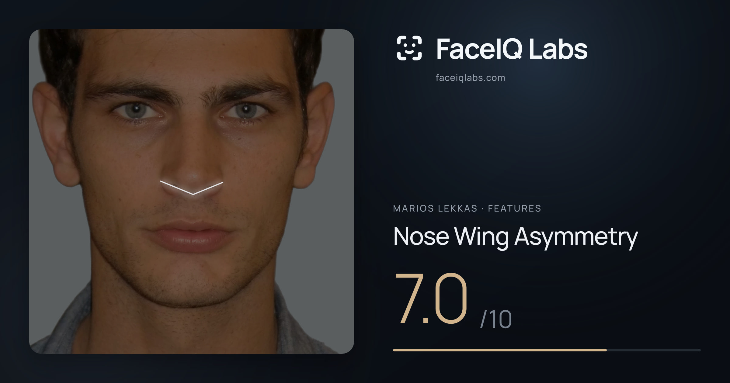 Marios Lekkas Nose Wing Asymmetry: 7.0/10, drawn on the photo