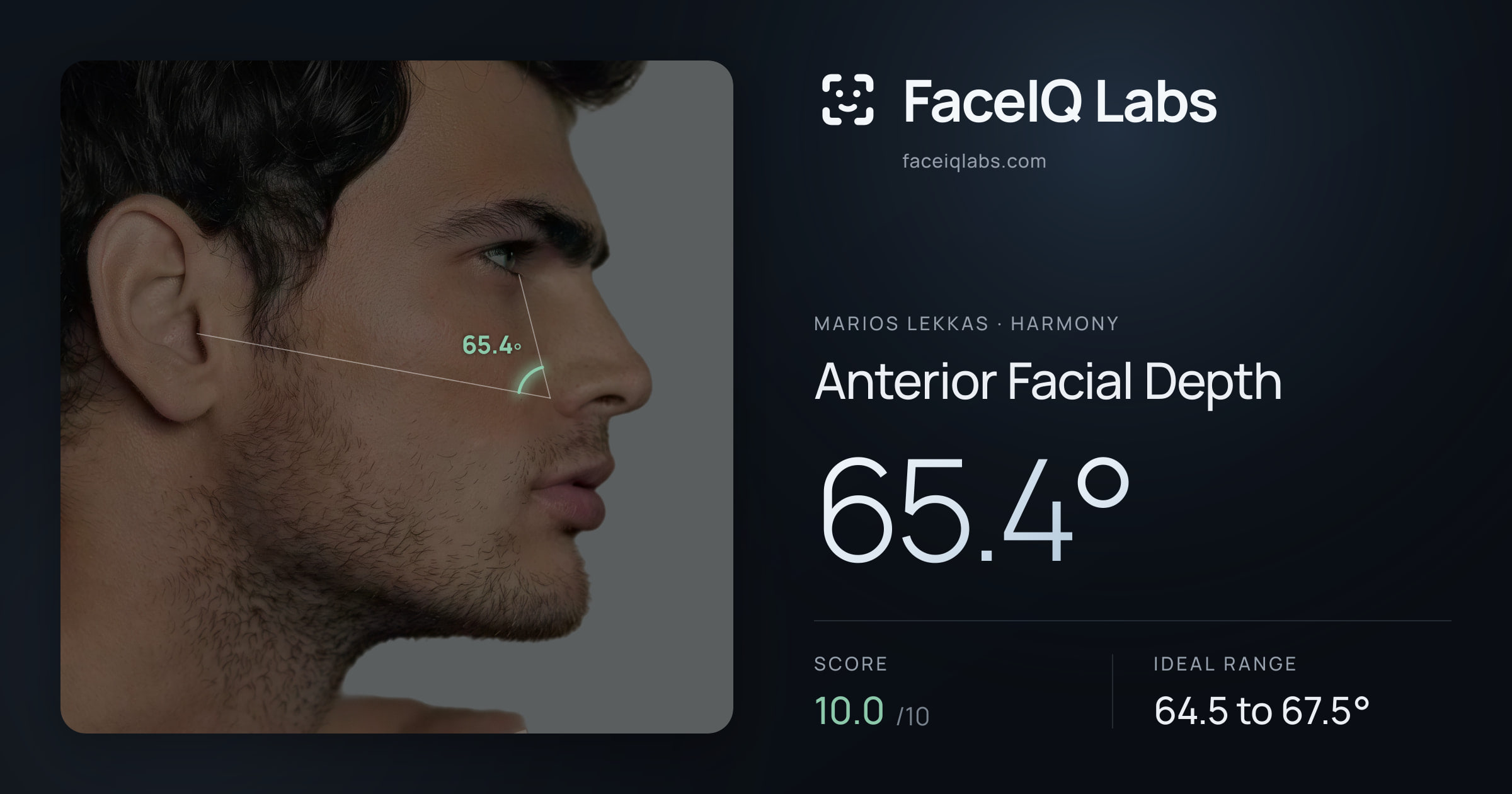Marios Lekkas Anterior Facial Depth: 65.4°, drawn on the photo