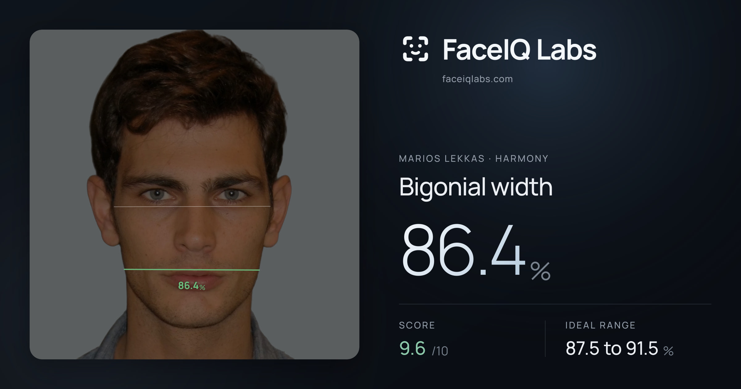 Marios Lekkas Bigonial width: 86.4%, drawn on the photo