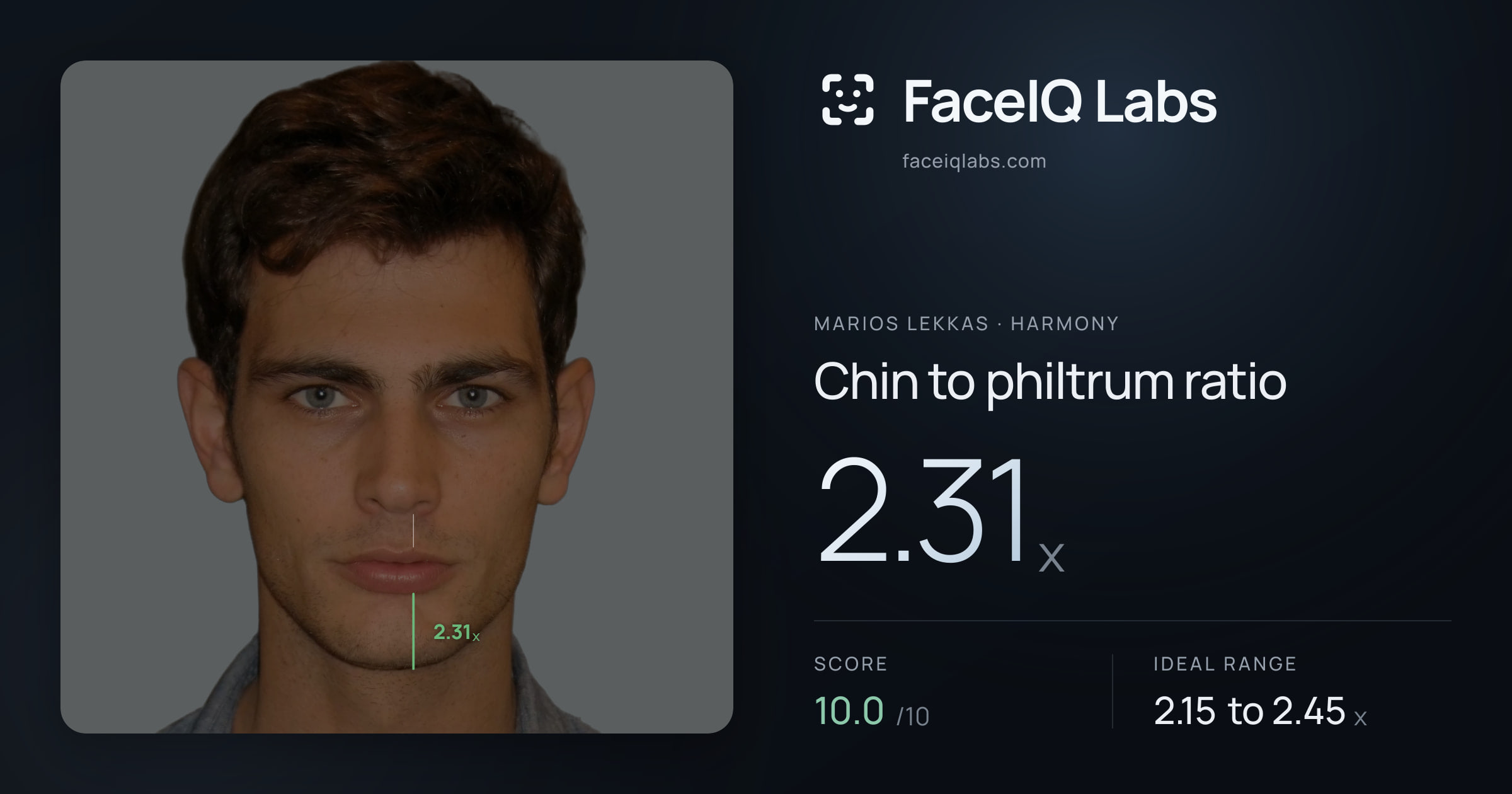 Marios Lekkas Chin to philtrum ratio: 2.31x, drawn on the photo