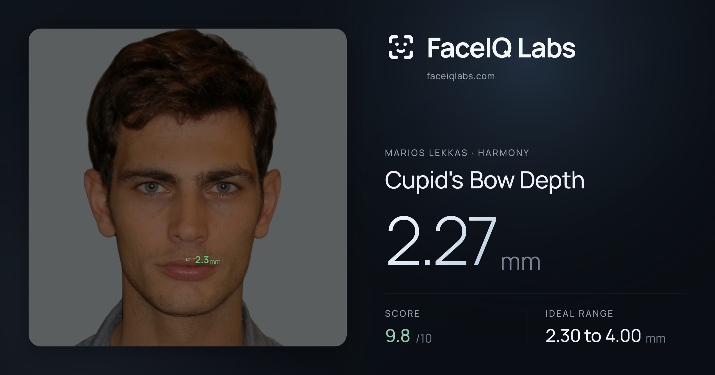 Marios Lekkas Cupid's Bow Depth: 2.27mm, drawn on the photo