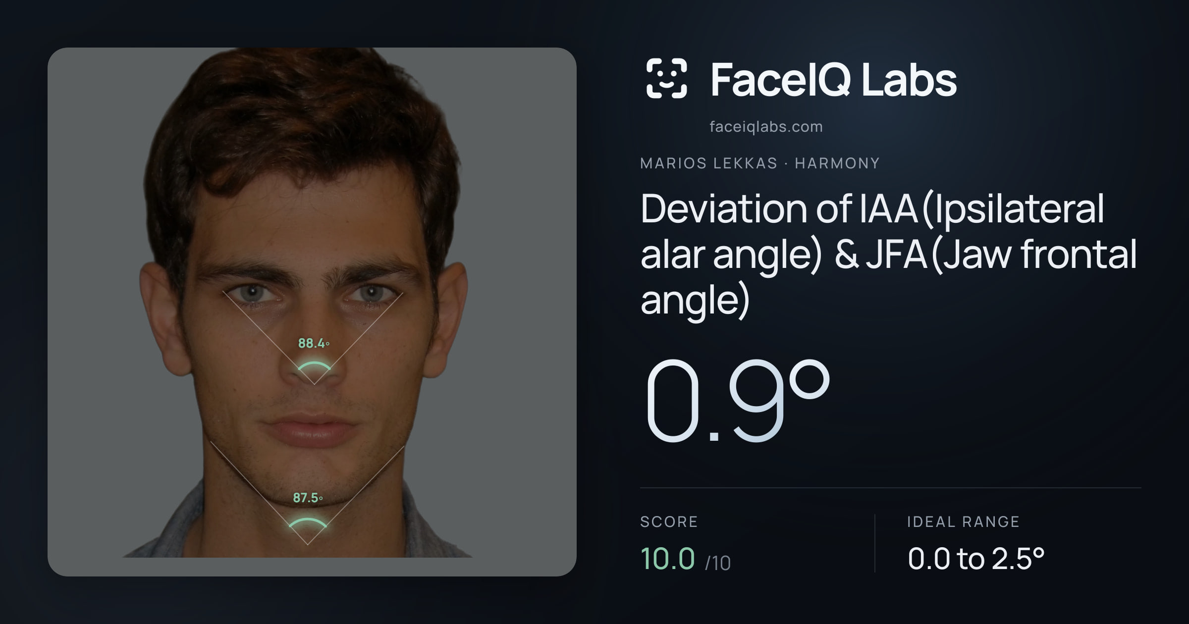 Marios Lekkas Deviation of IAA(Ipsilateral alar angle) & JFA(Jaw frontal angle): 0.9°, drawn on the photo