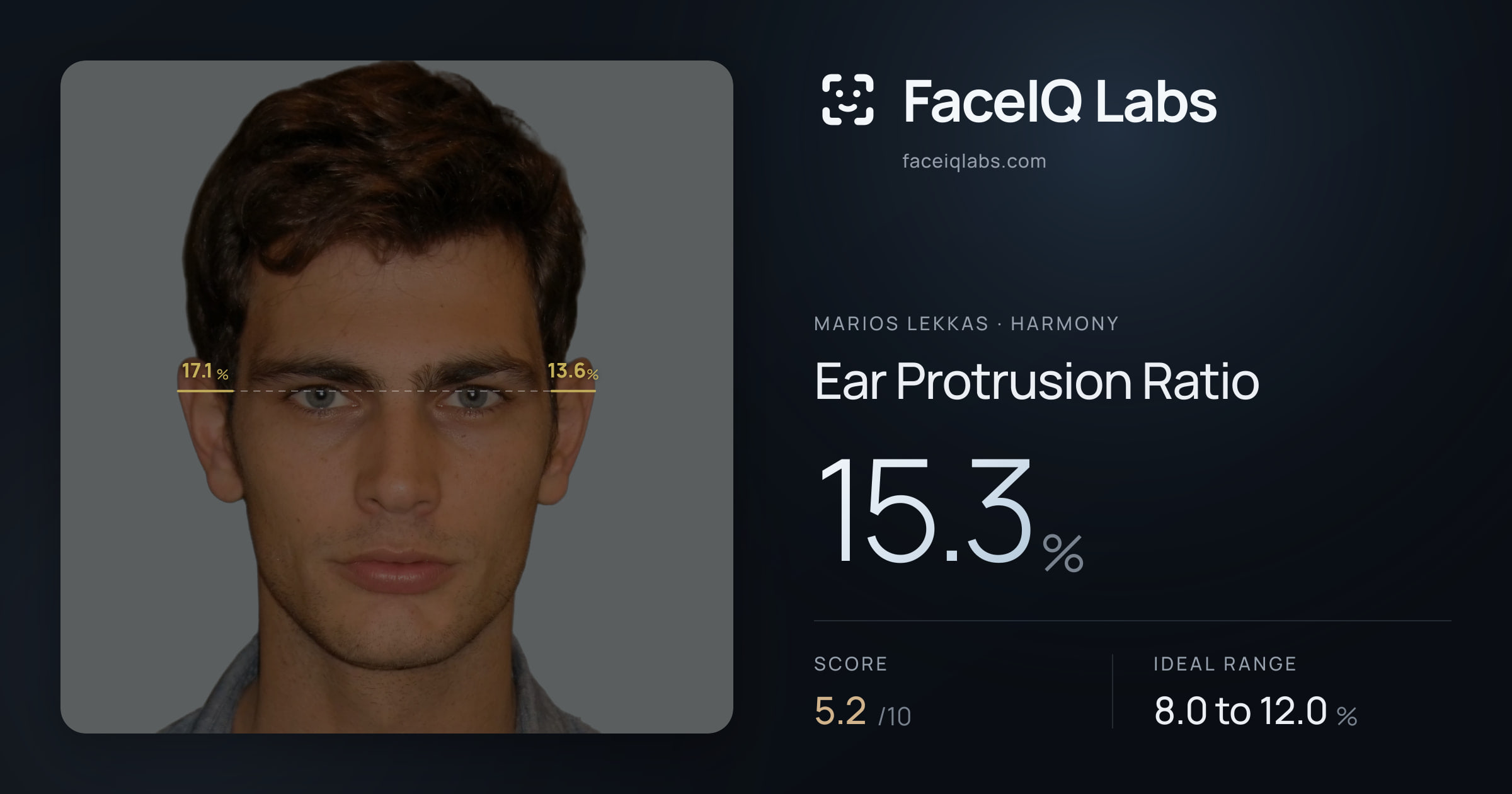 Marios Lekkas Ear Protrusion Ratio: 15.3%, drawn on the photo