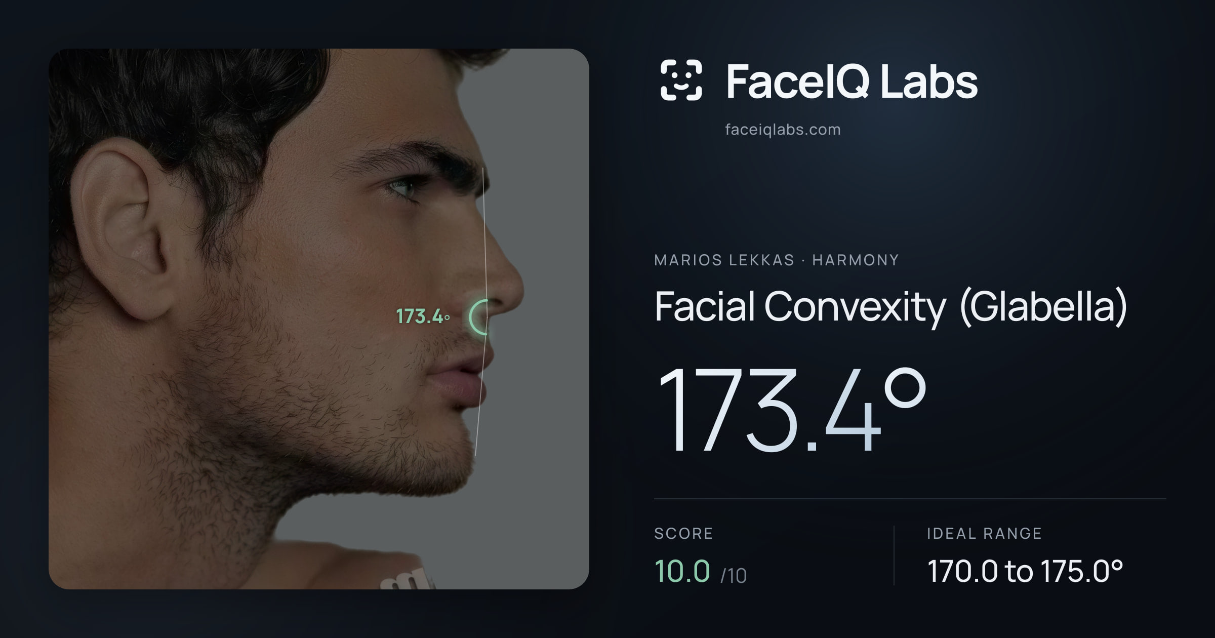 Marios Lekkas Facial Convexity (Glabella): 173.4°, drawn on the photo