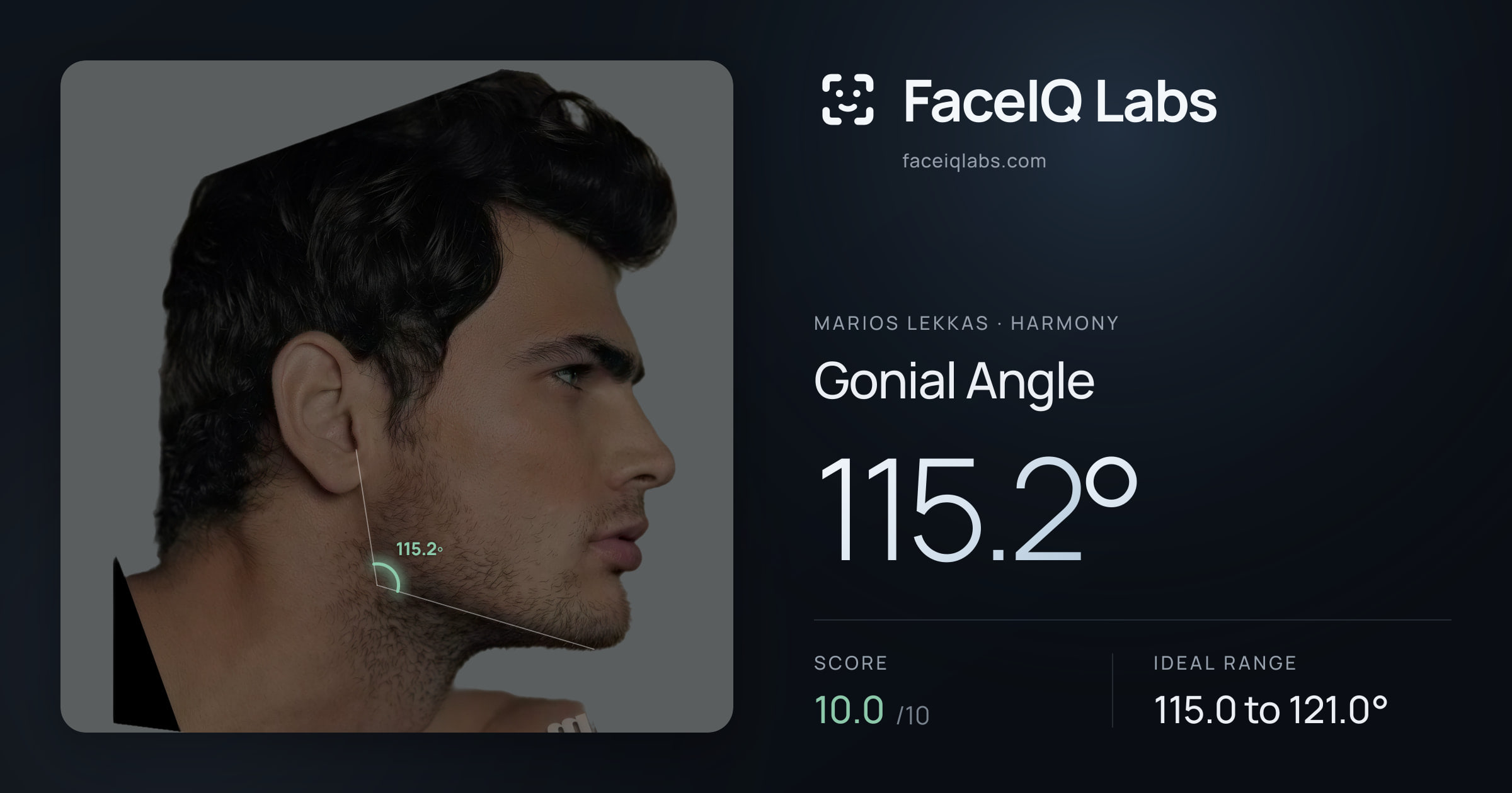 Marios Lekkas Gonial Angle: 115.2°, drawn on the photo
