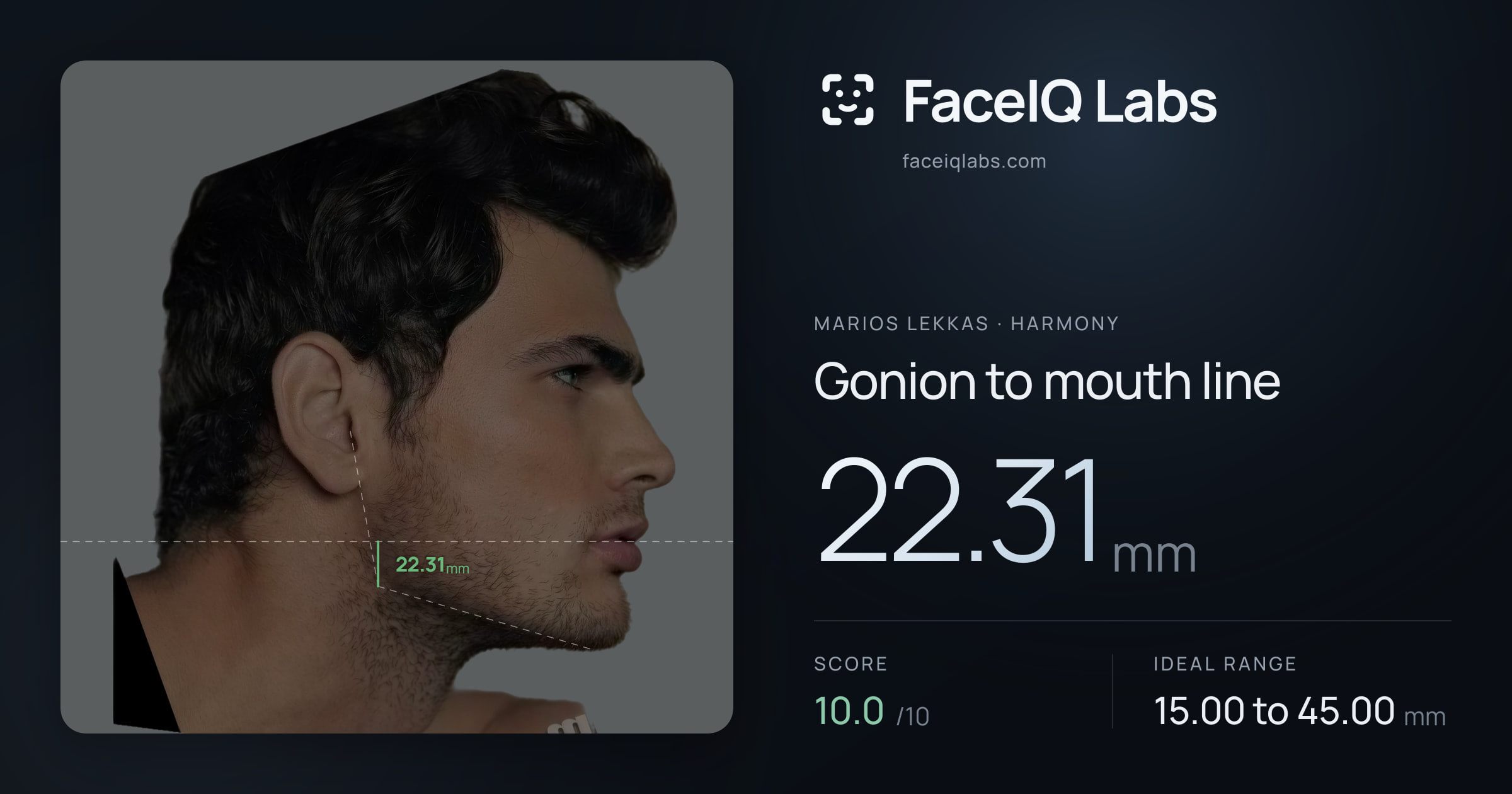 Marios Lekkas Gonion to mouth line: 22.31mm, drawn on the photo