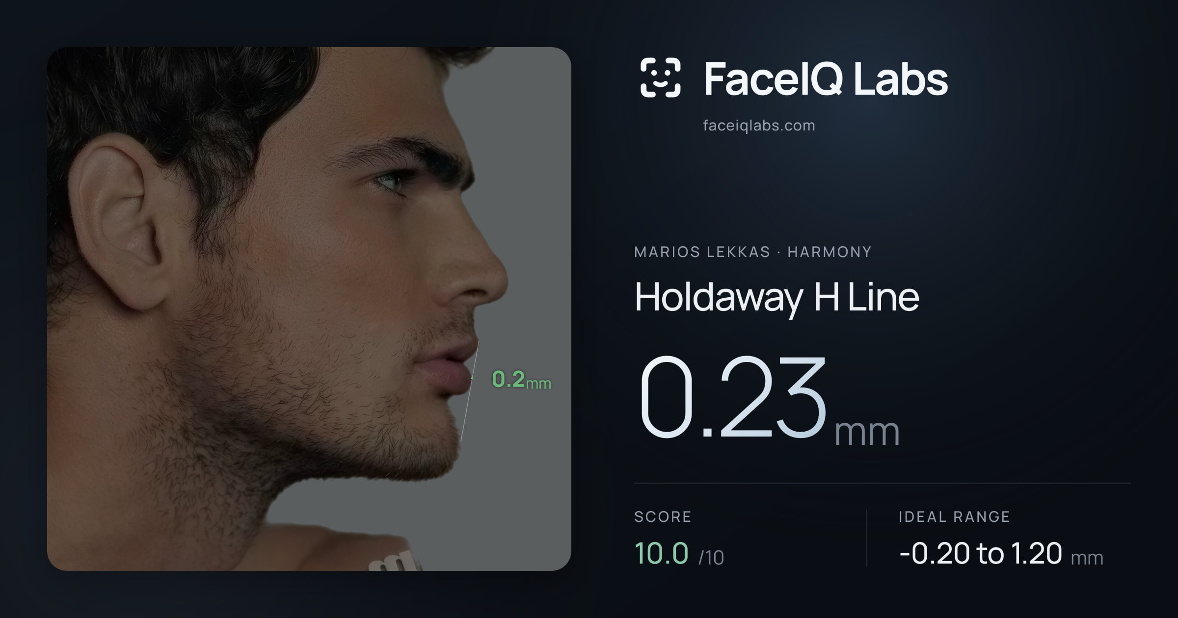 Marios Lekkas Holdaway H Line: 0.23mm, drawn on the photo