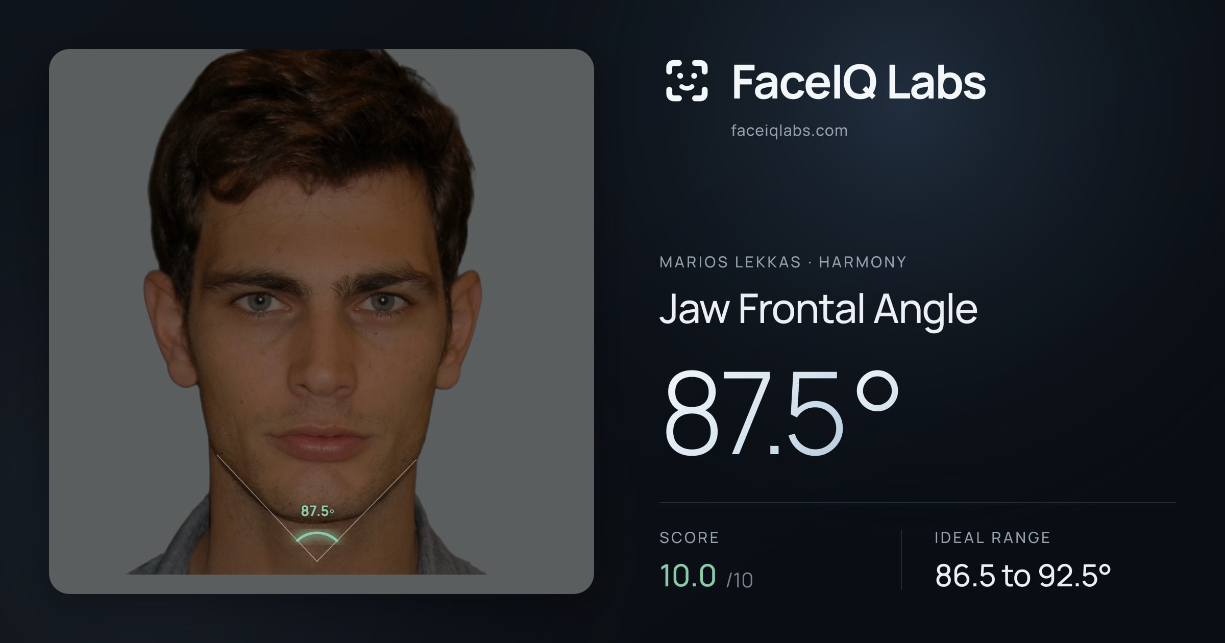Marios Lekkas Jaw Frontal Angle: 87.5°, drawn on the photo