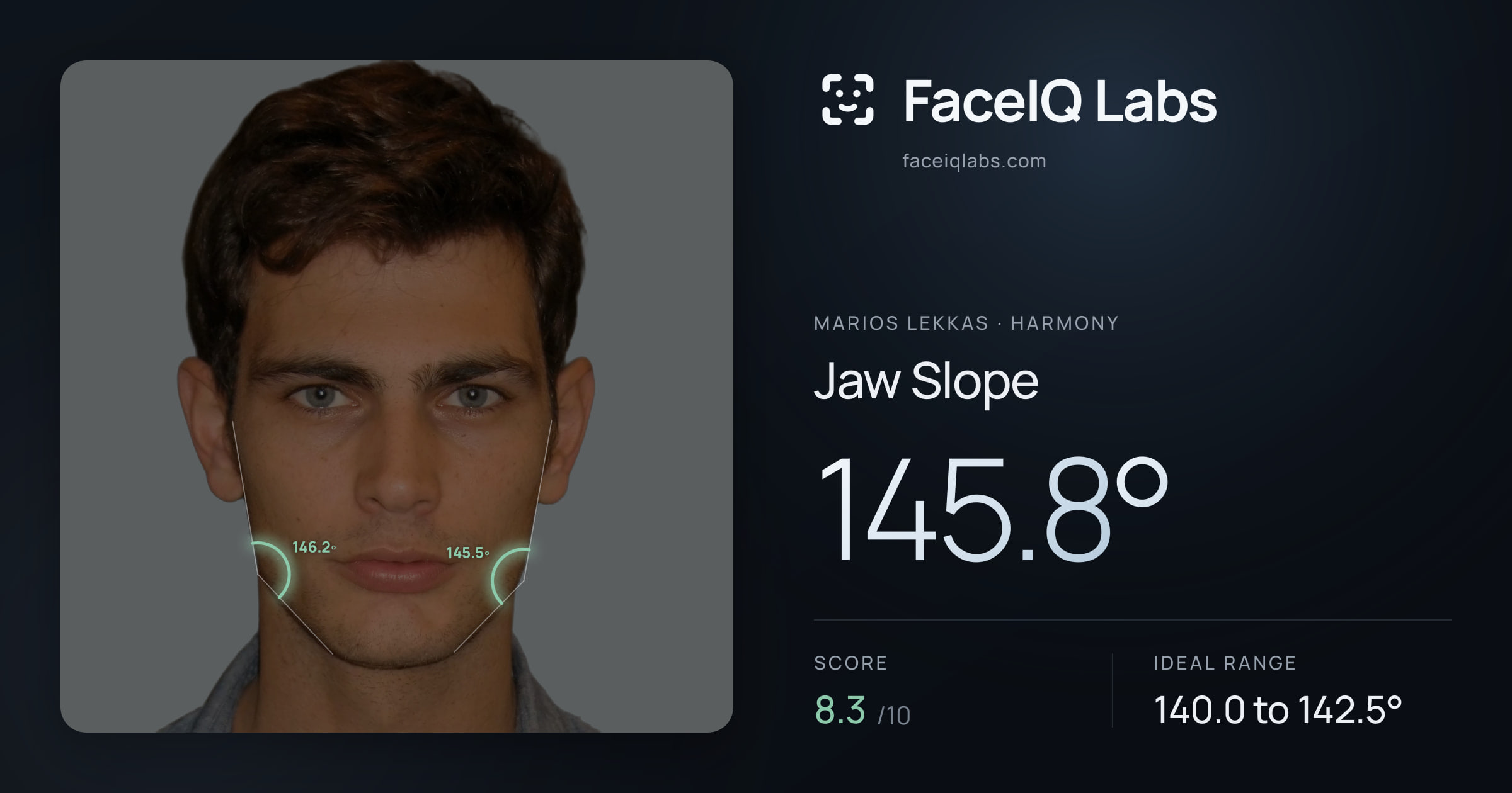 Marios Lekkas Jaw Slope: 145.8°, drawn on the photo