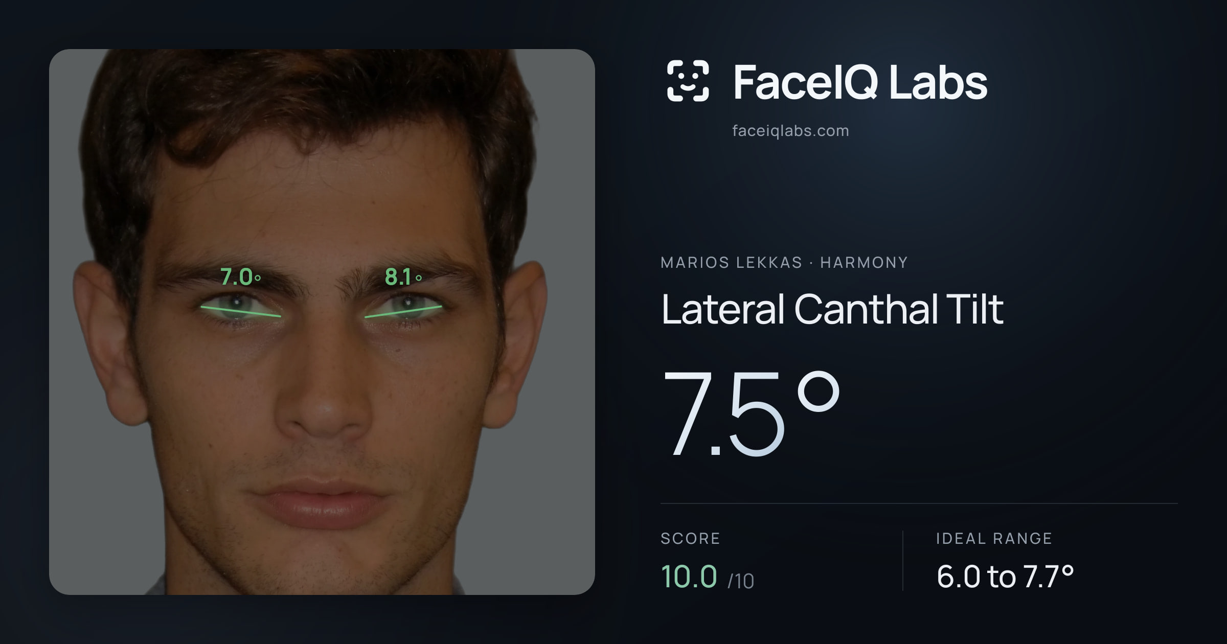 Marios Lekkas Lateral Canthal Tilt: 7.5°, drawn on the photo