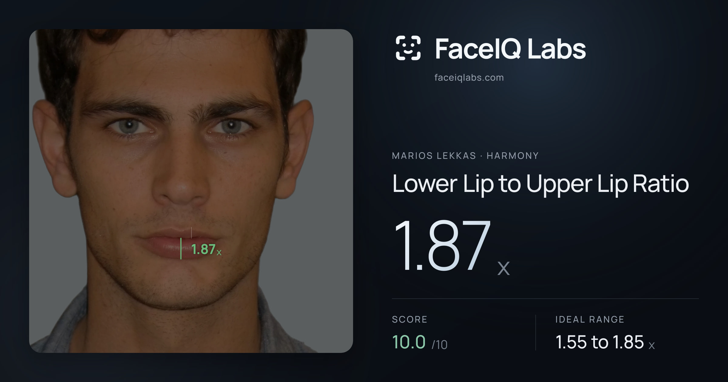 Marios Lekkas Lower Lip to Upper Lip Ratio: 1.87x, drawn on the photo