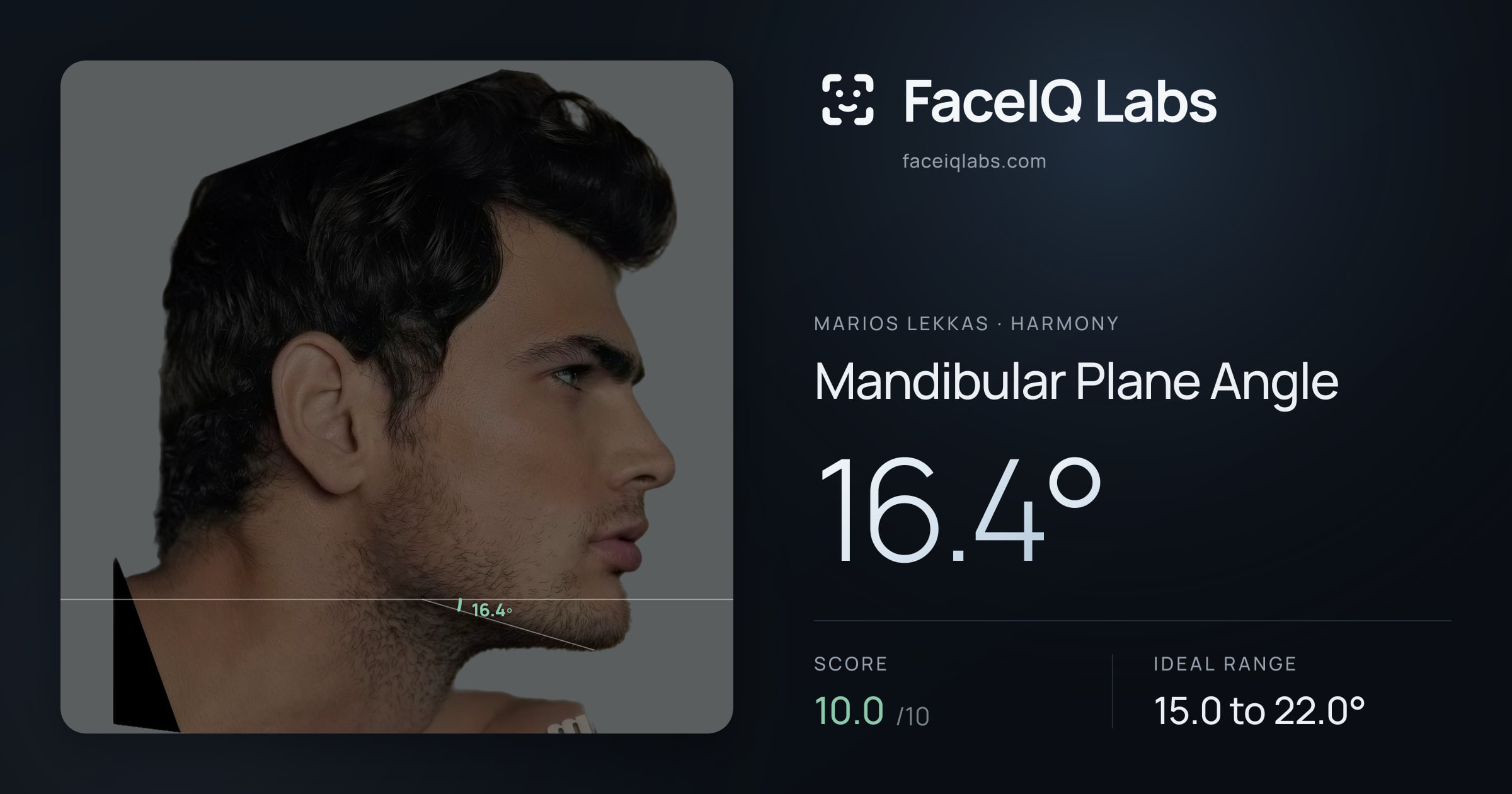 Marios Lekkas Mandibular Plane Angle: 16.4°, drawn on the photo