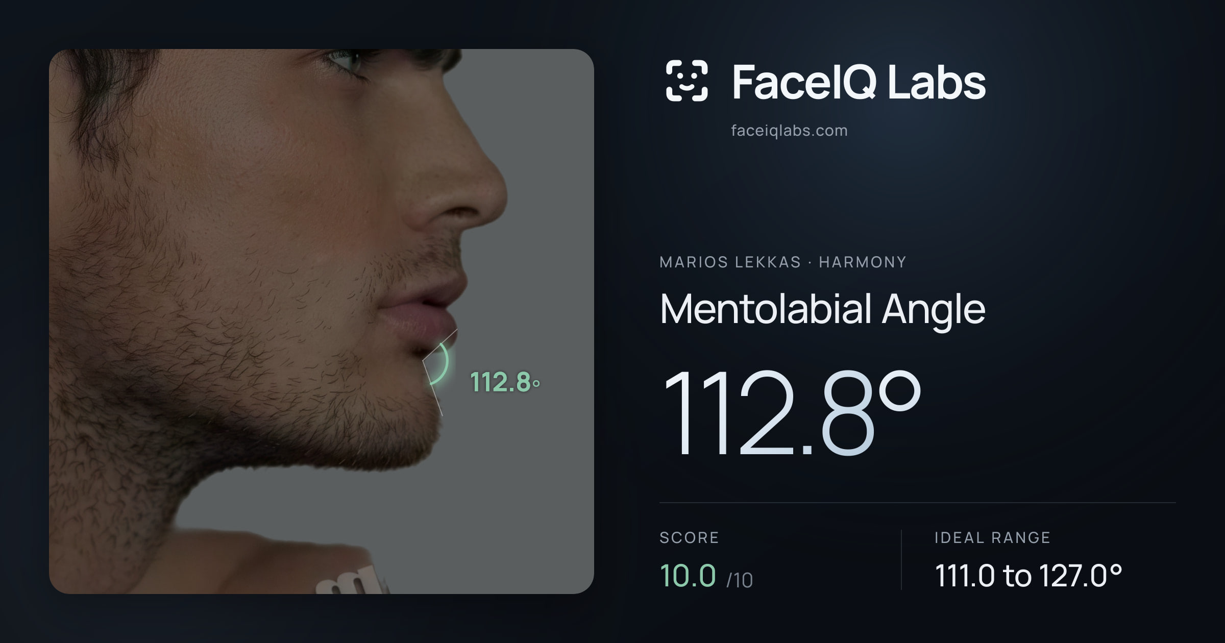 Marios Lekkas Mentolabial Angle: 112.8°, drawn on the photo