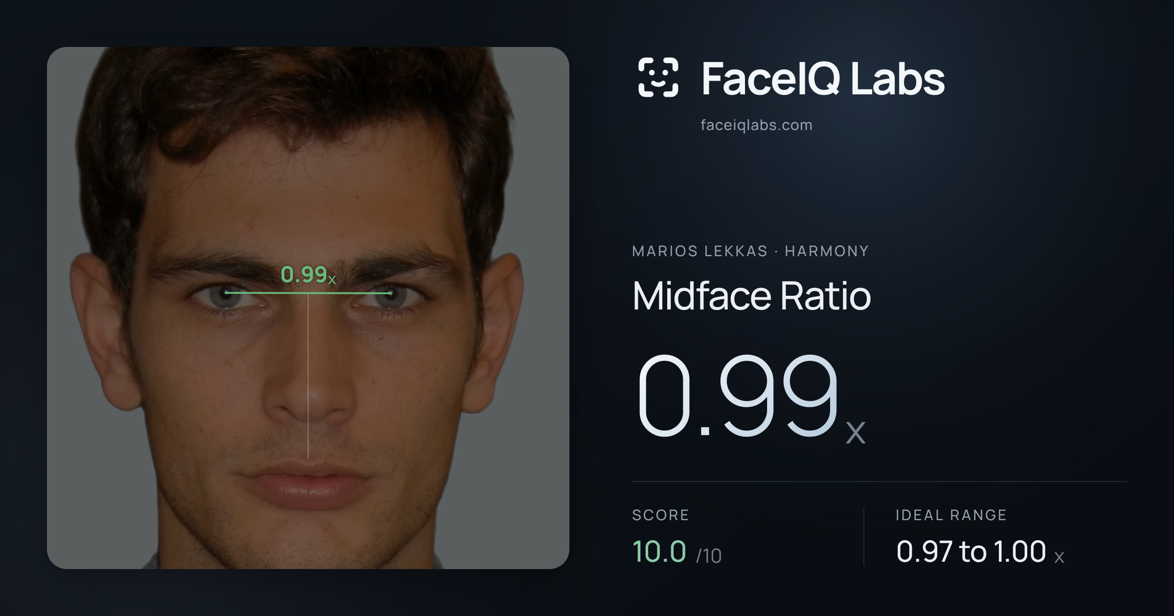 Marios Lekkas Midface Ratio: 0.99x, drawn on the photo