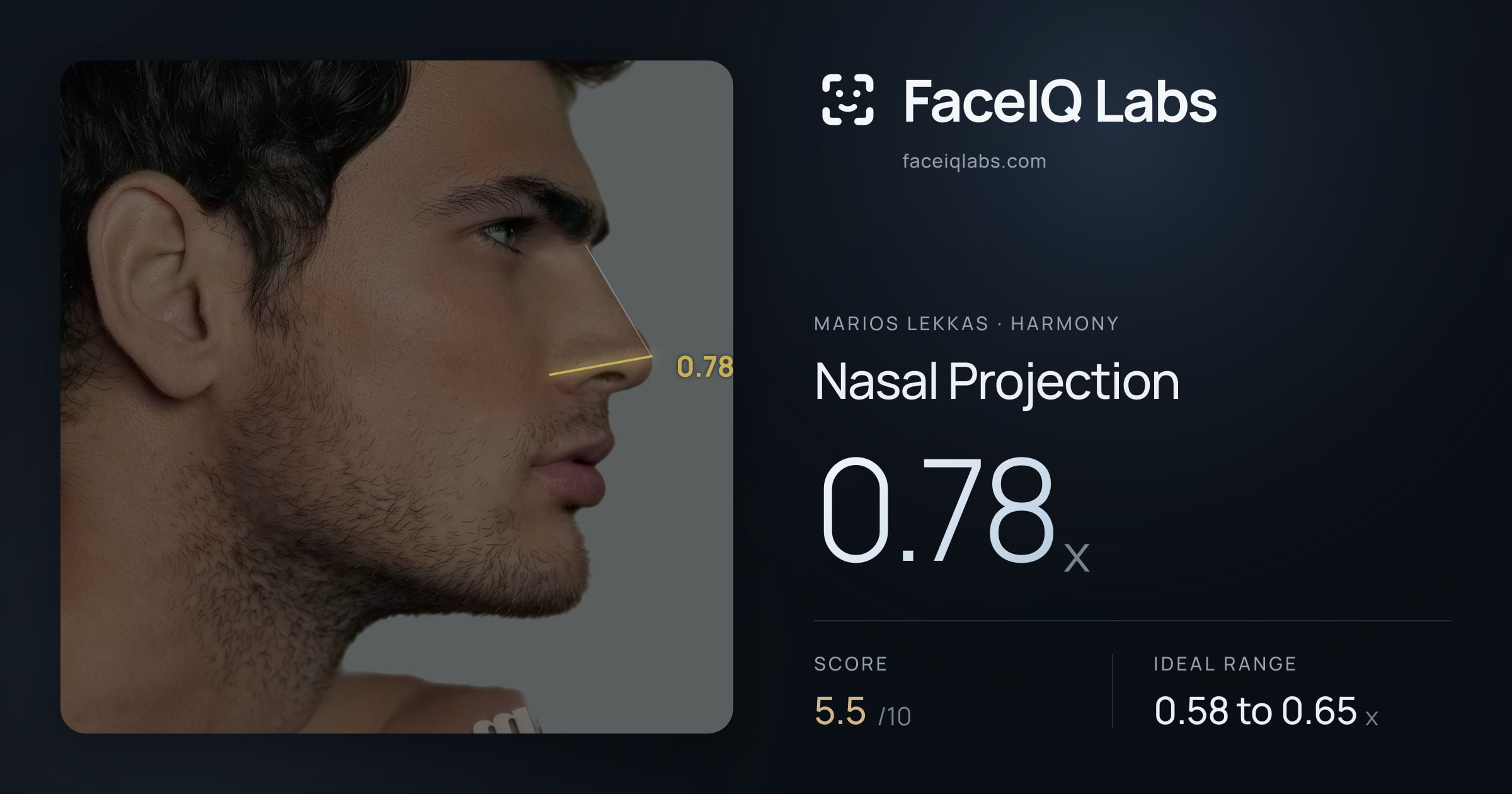 Marios Lekkas Nasal Projection: 0.78x, drawn on the photo