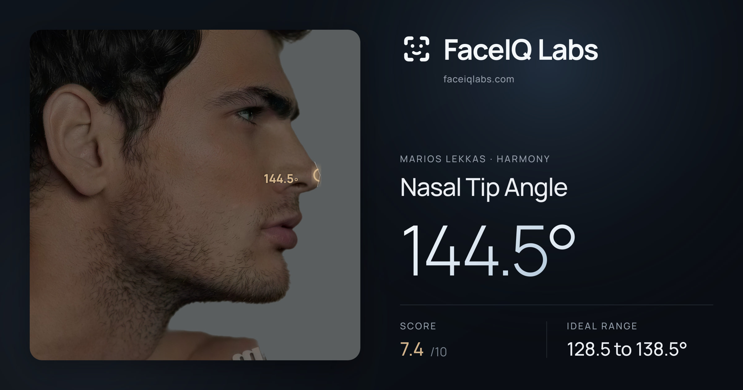 Marios Lekkas Nasal Tip Angle: 144.5°, drawn on the photo