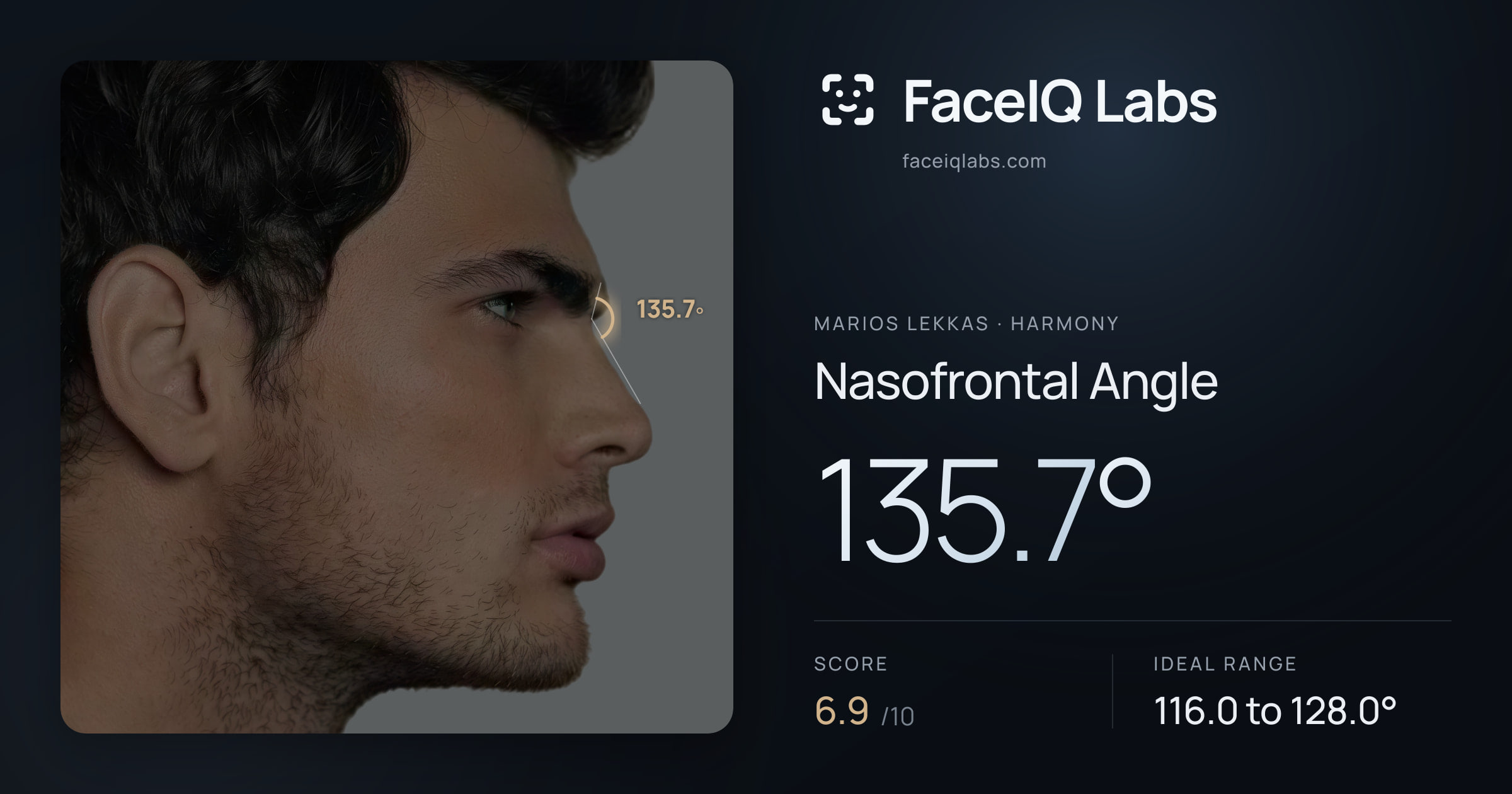 Marios Lekkas Nasofrontal Angle: 135.7°, drawn on the photo
