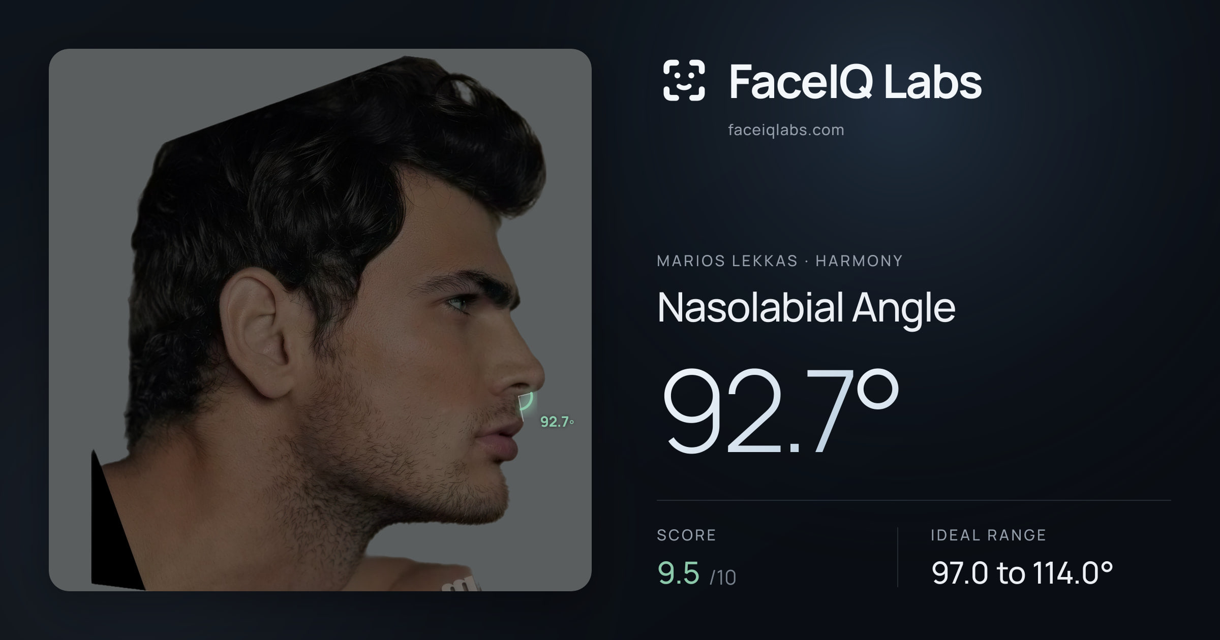 Marios Lekkas Nasolabial Angle: 92.7°, drawn on the photo