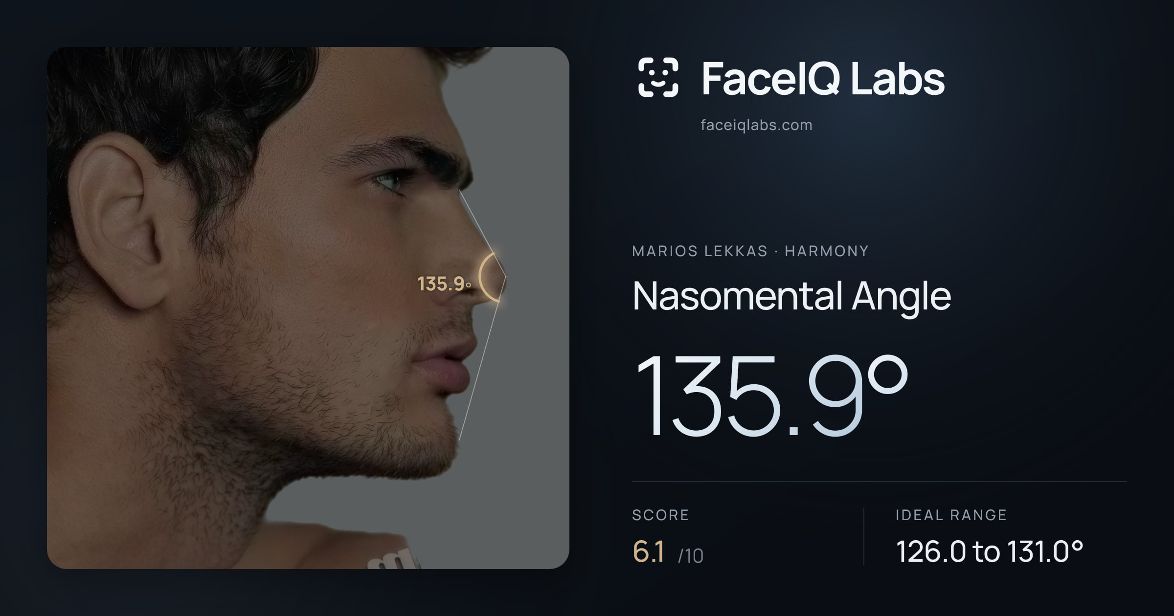 Marios Lekkas Nasomental Angle: 135.9°, drawn on the photo