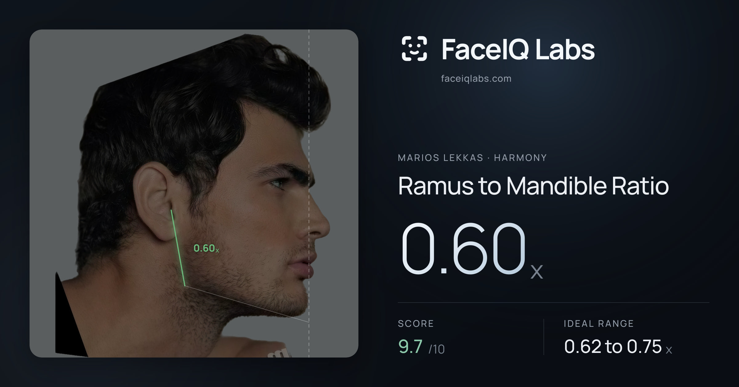 Marios Lekkas Ramus to Mandible Ratio: 0.60x, drawn on the photo
