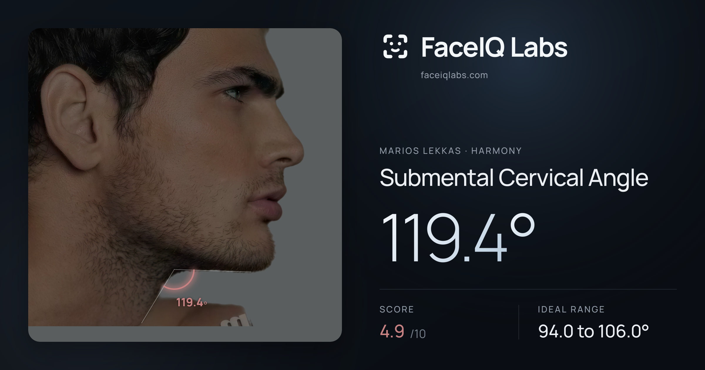 Marios Lekkas Submental Cervical Angle: 119.4°, drawn on the photo