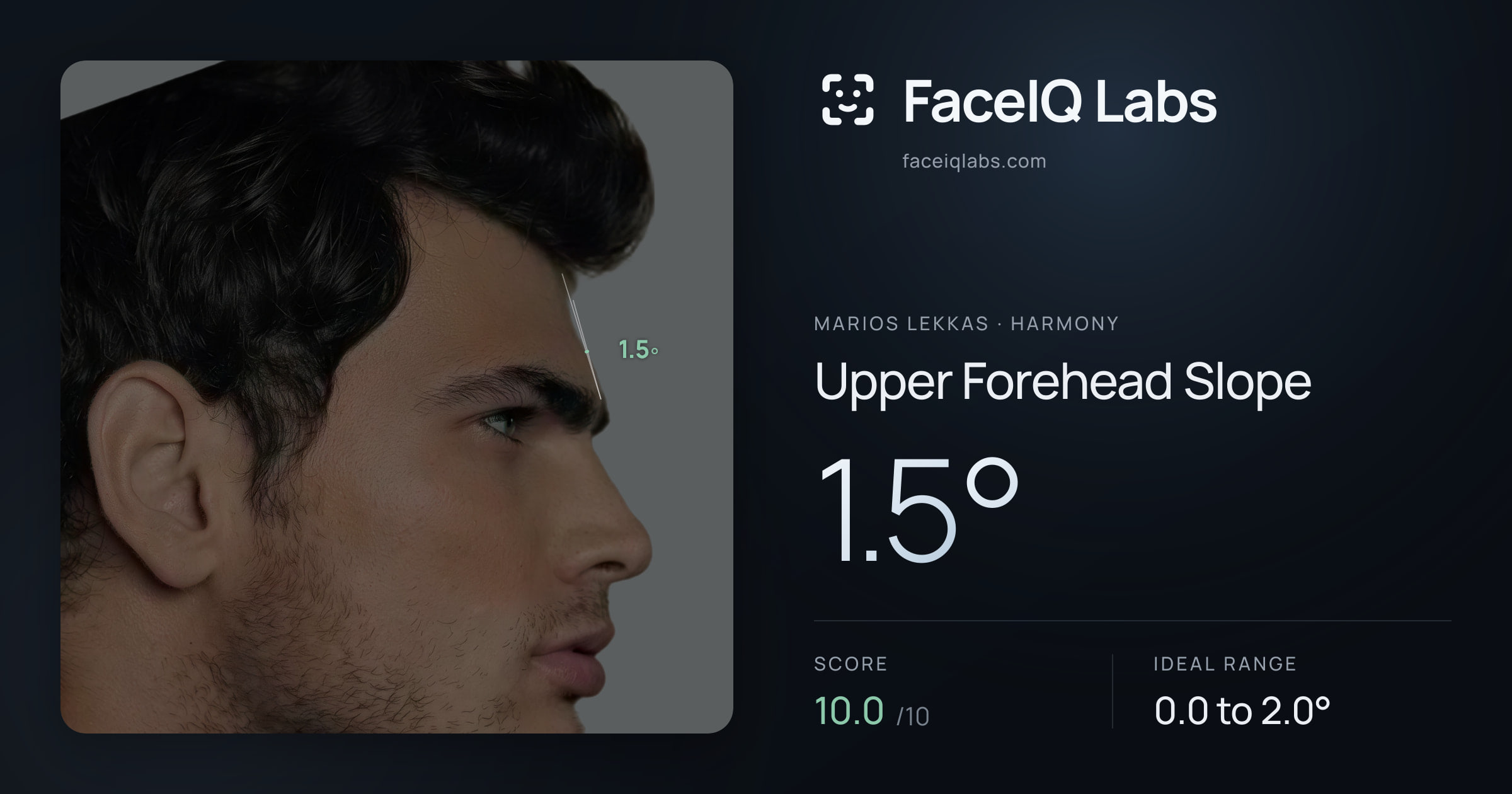 Marios Lekkas Upper Forehead Slope: 1.5°, drawn on the photo