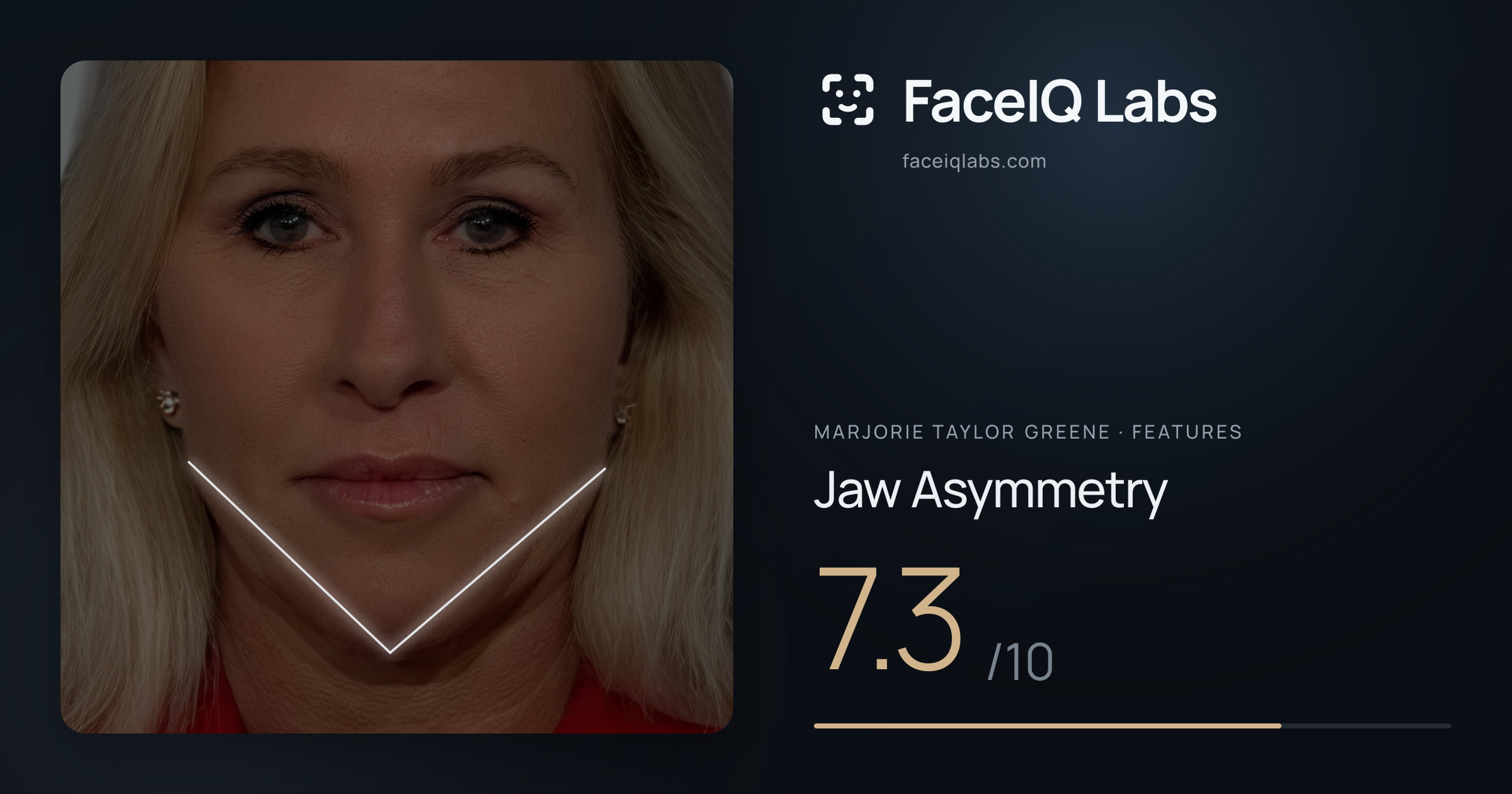 Marjorie Taylor Greene Jaw Asymmetry: 7.3/10, drawn on the photo