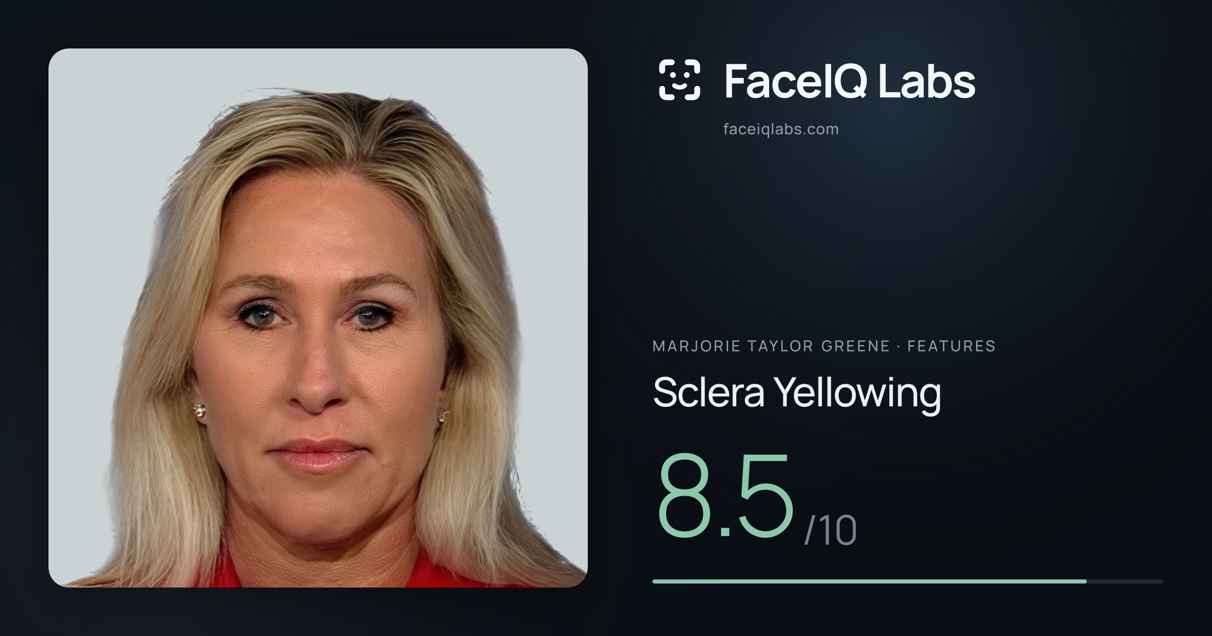 Marjorie Taylor Greene Sclera Yellowing: 8.5/10, drawn on the photo