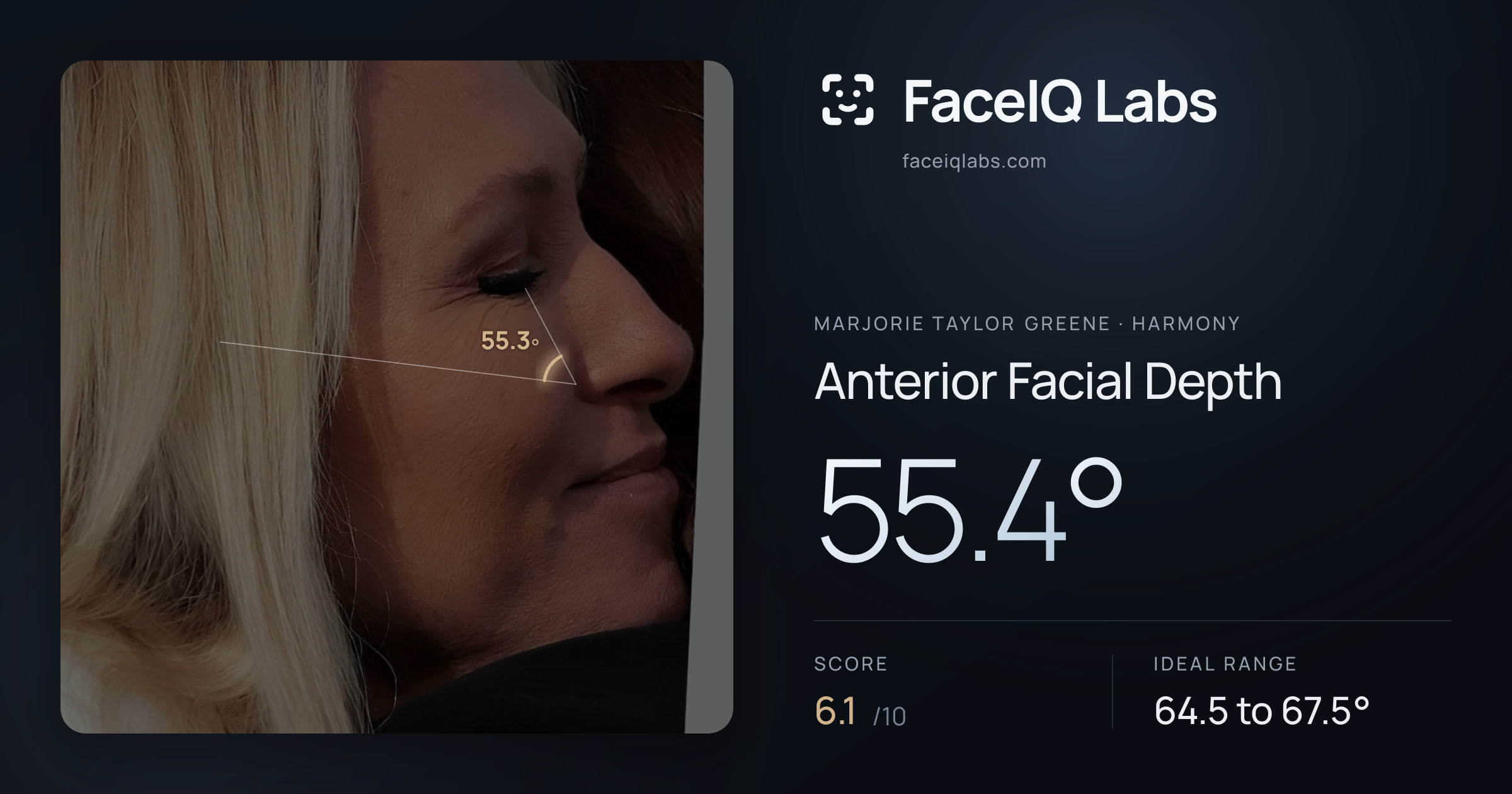 Marjorie Taylor Greene Anterior Facial Depth: 55.4°, drawn on the photo