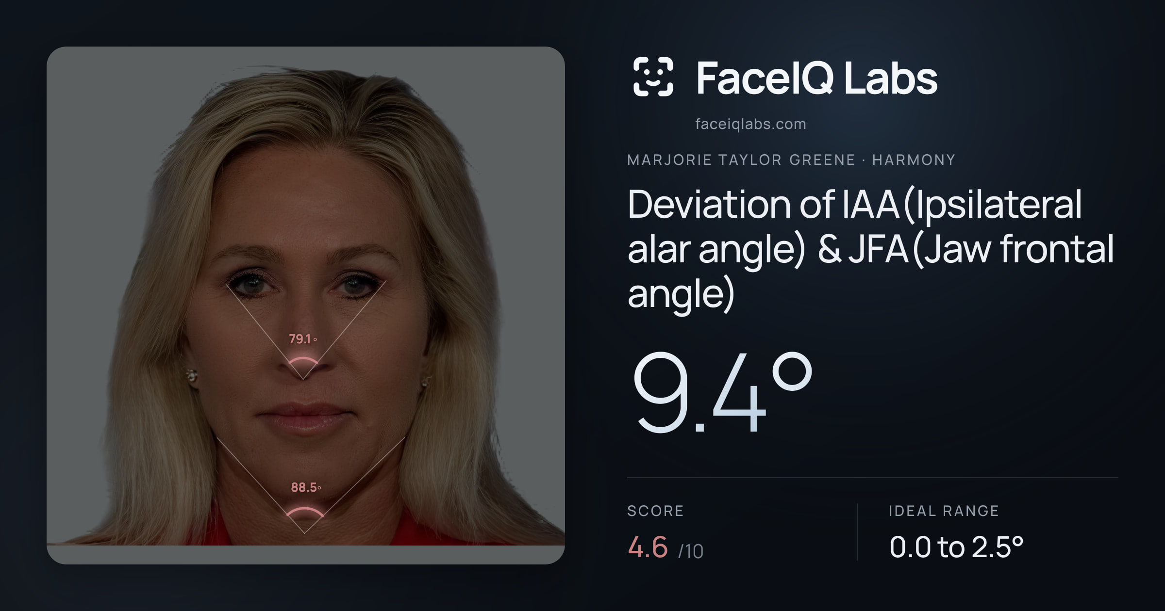 Marjorie Taylor Greene Deviation of IAA(Ipsilateral alar angle) & JFA(Jaw frontal angle): 9.4°, drawn on the photo