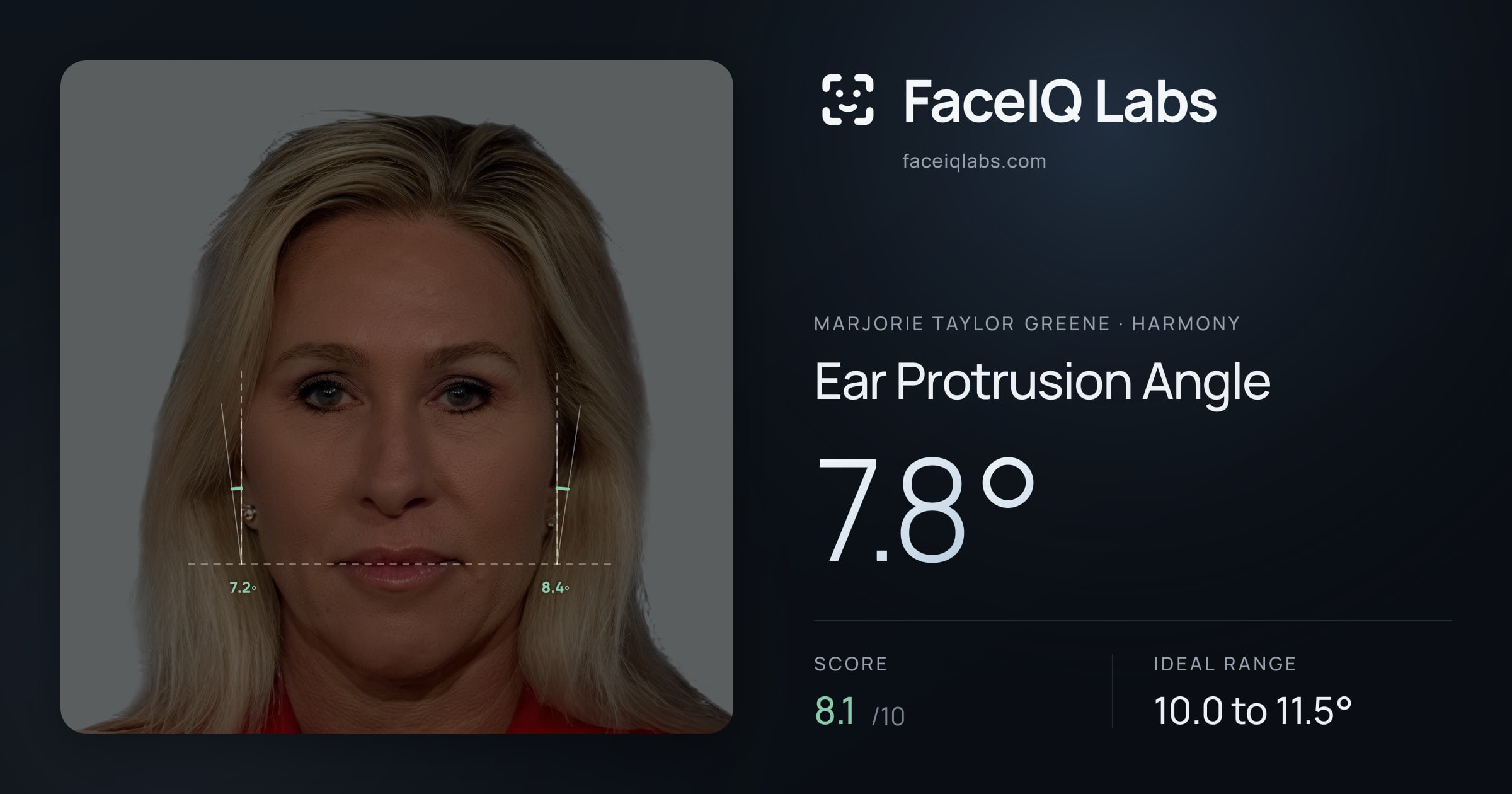 Marjorie Taylor Greene Ear Protrusion Angle: 7.8°, drawn on the photo