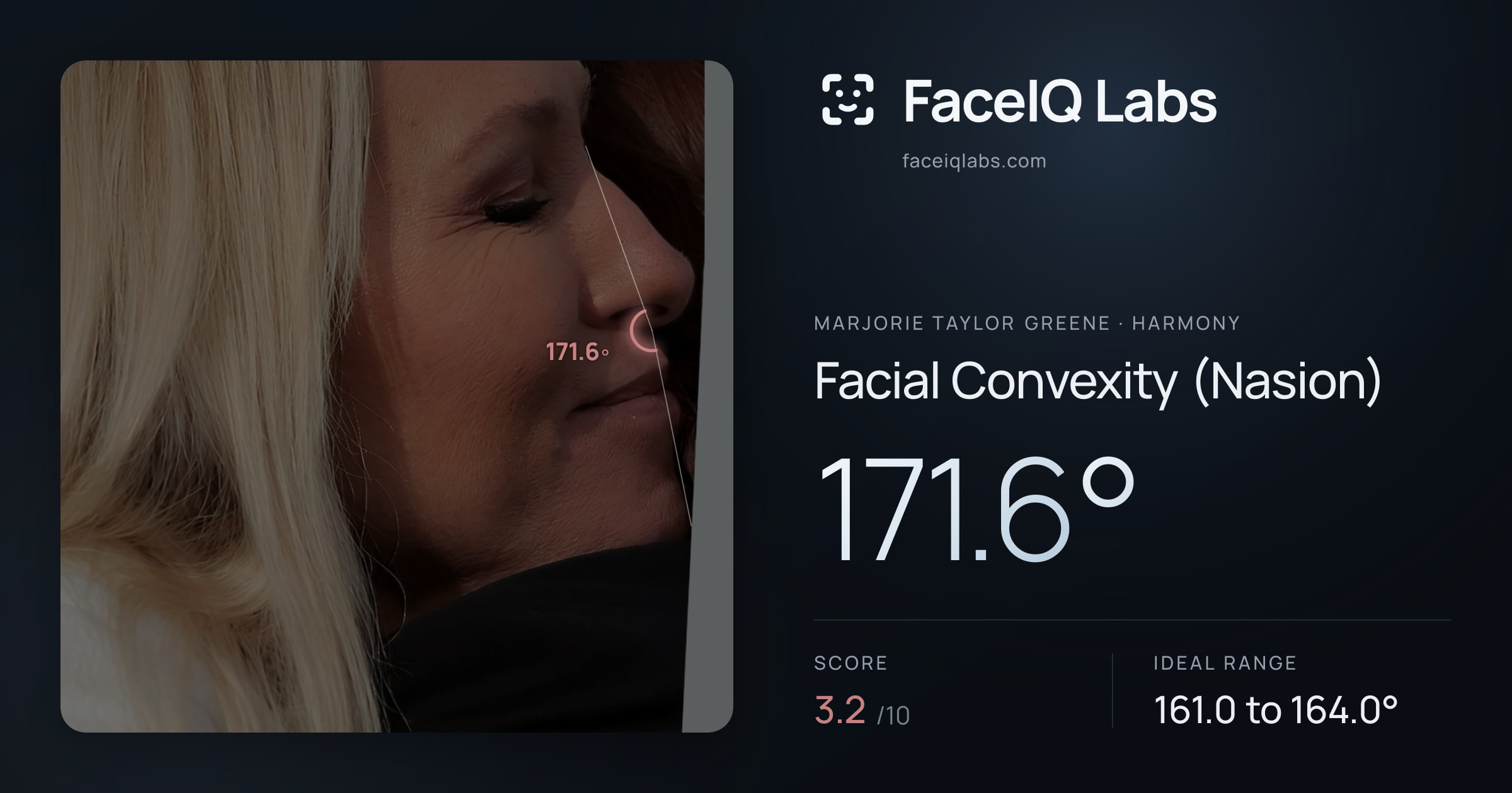 Marjorie Taylor Greene Facial Convexity (Nasion): 171.6°, drawn on the photo