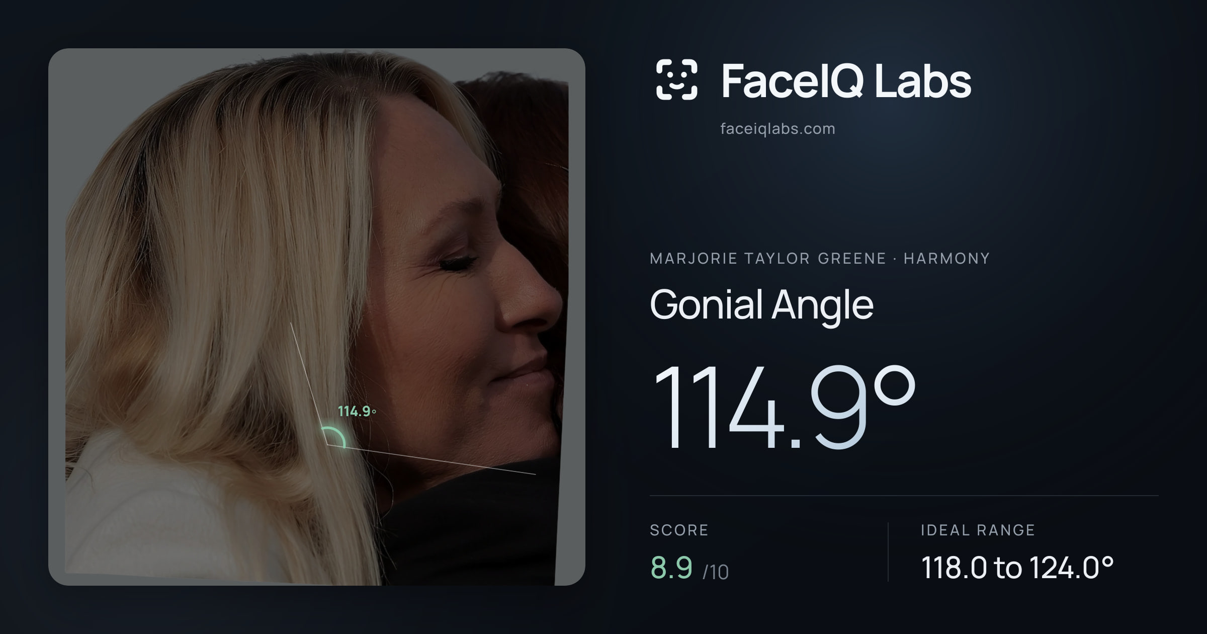 Marjorie Taylor Greene Gonial Angle: 114.9°, drawn on the photo