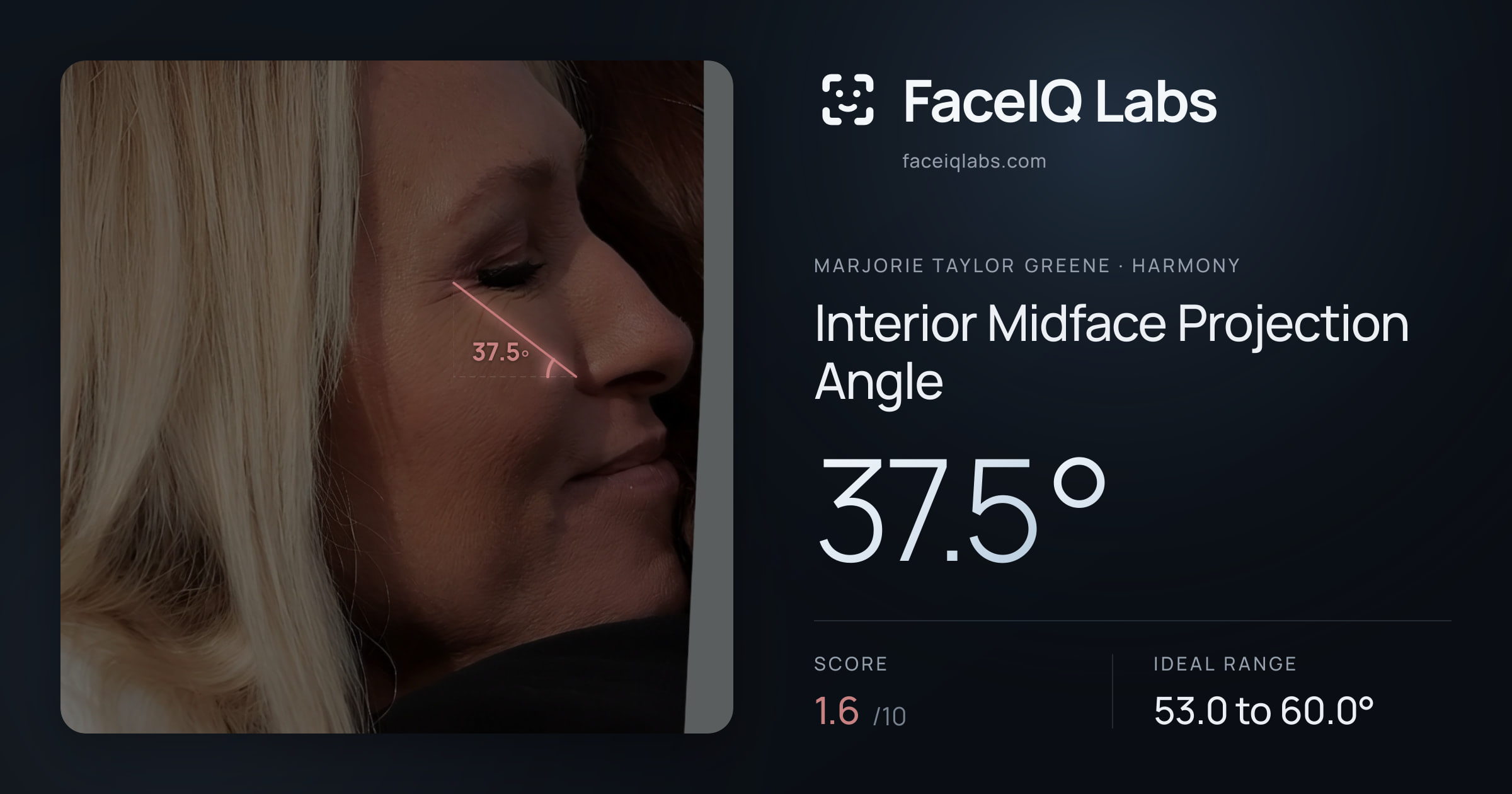 Marjorie Taylor Greene Interior Midface Projection Angle: 37.5°, drawn on the photo
