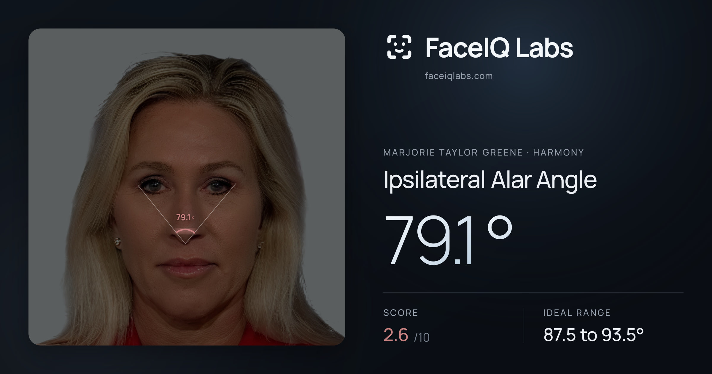 Marjorie Taylor Greene Ipsilateral Alar Angle: 79.1°, drawn on the photo