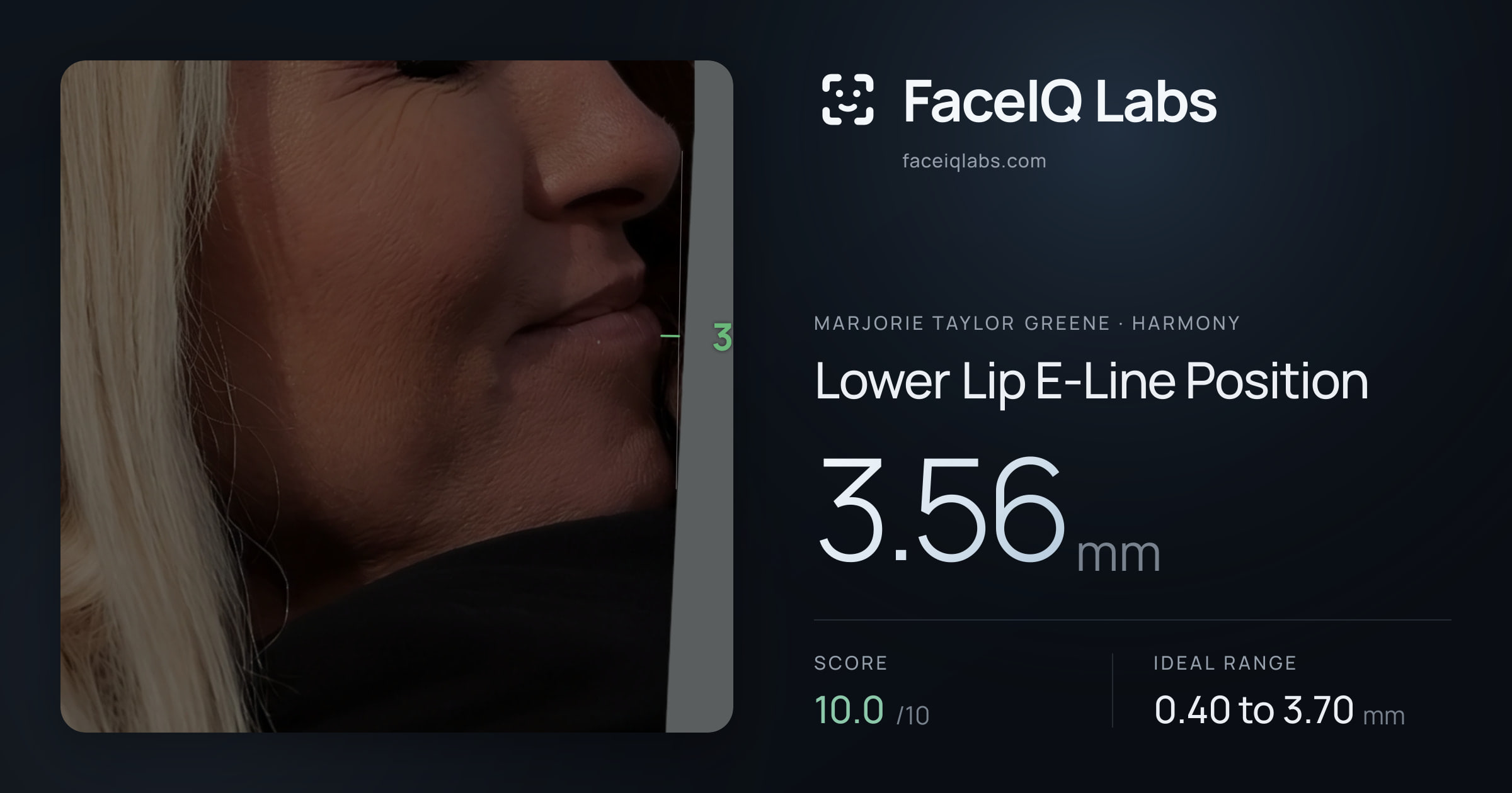 Marjorie Taylor Greene Lower Lip E-Line Position: 3.56mm, drawn on the photo