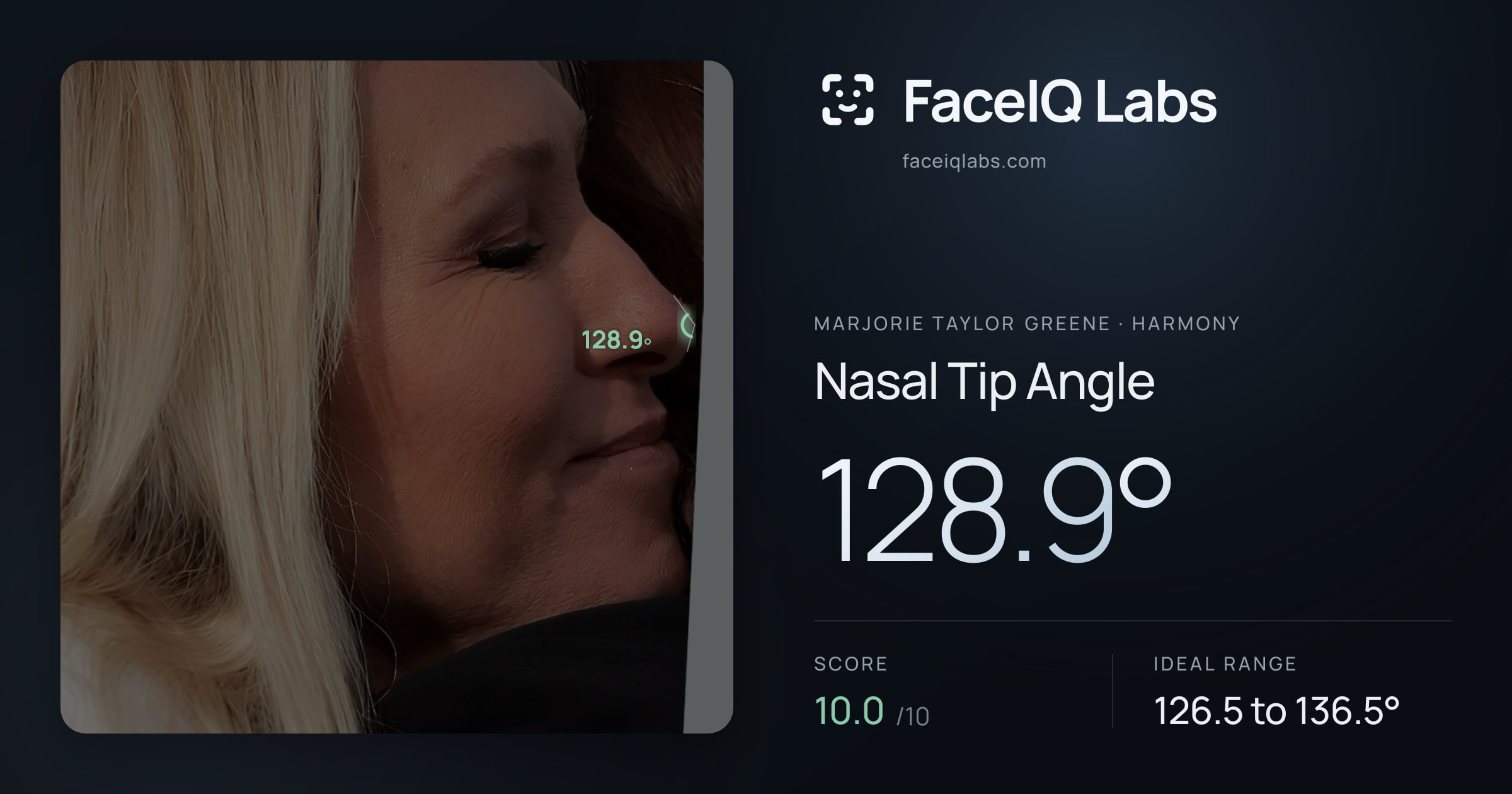Marjorie Taylor Greene Nasal Tip Angle: 128.9°, drawn on the photo