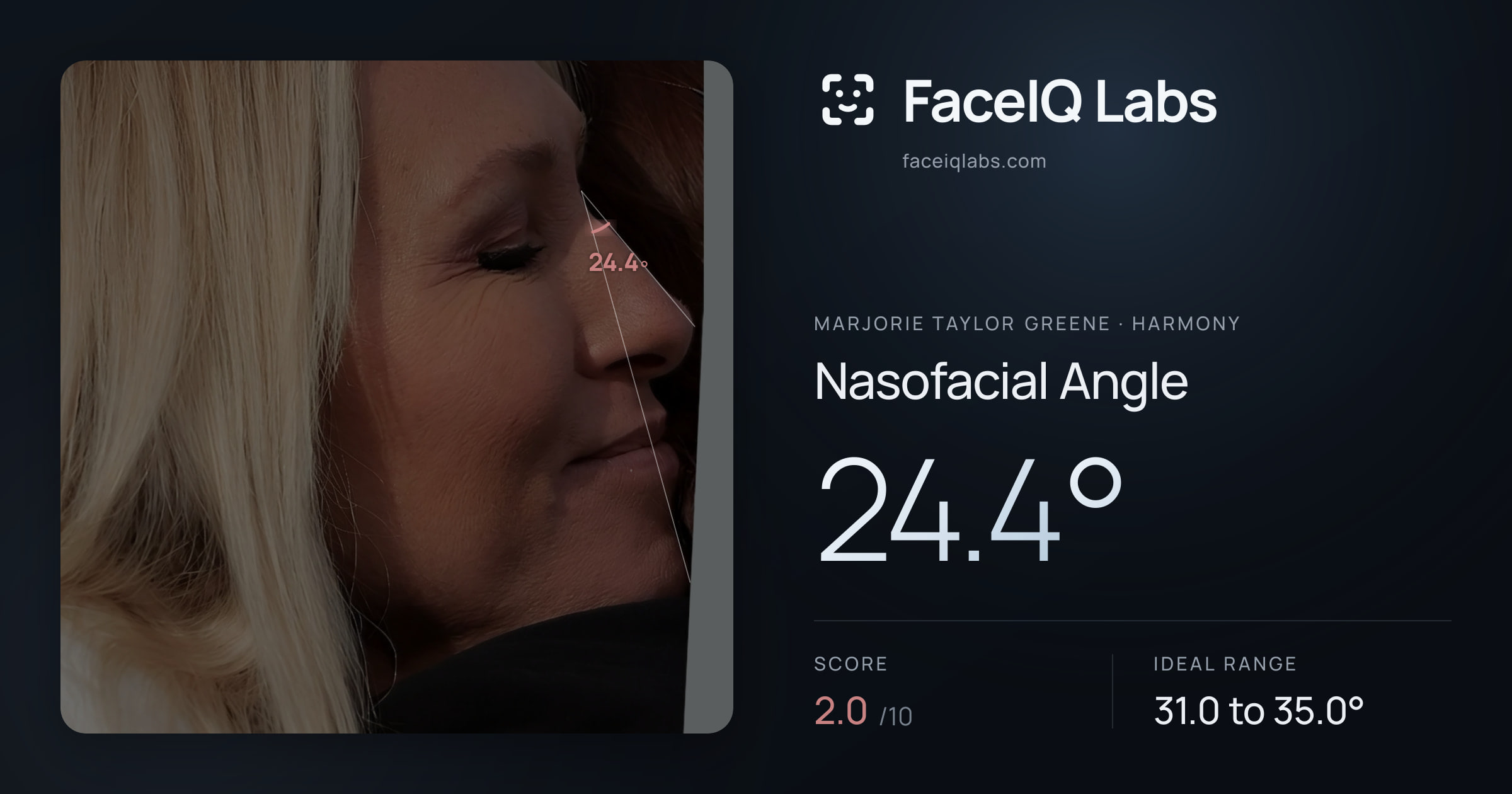 Marjorie Taylor Greene Nasofacial Angle: 24.4°, drawn on the photo