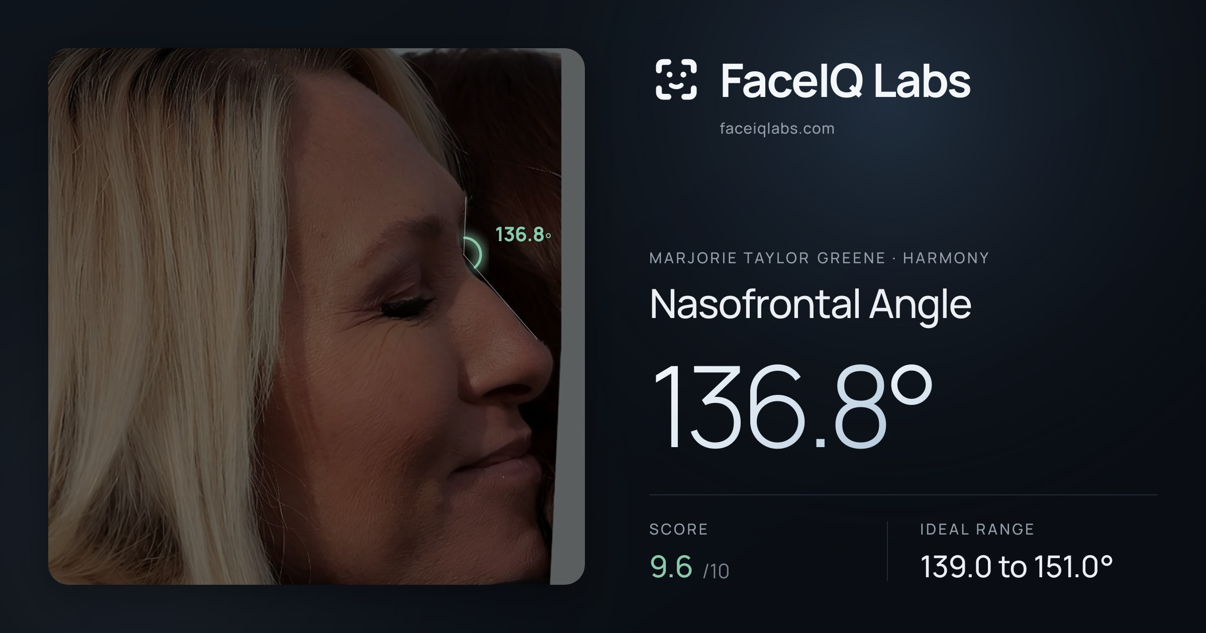 Marjorie Taylor Greene Nasofrontal Angle: 136.8°, drawn on the photo